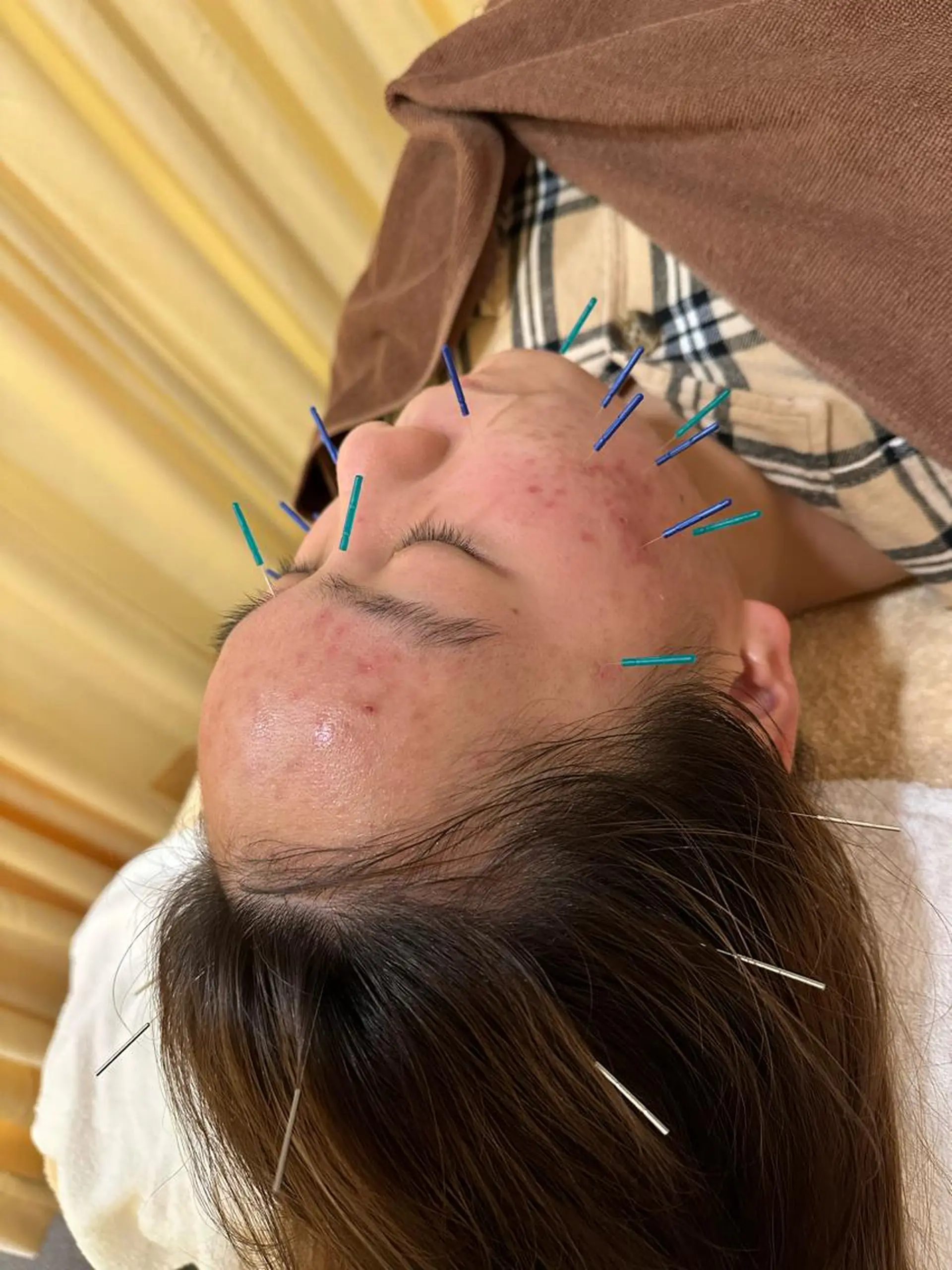 BBB3(ビースリー)所属・鍼灸サロン BBB3のその他イメージ