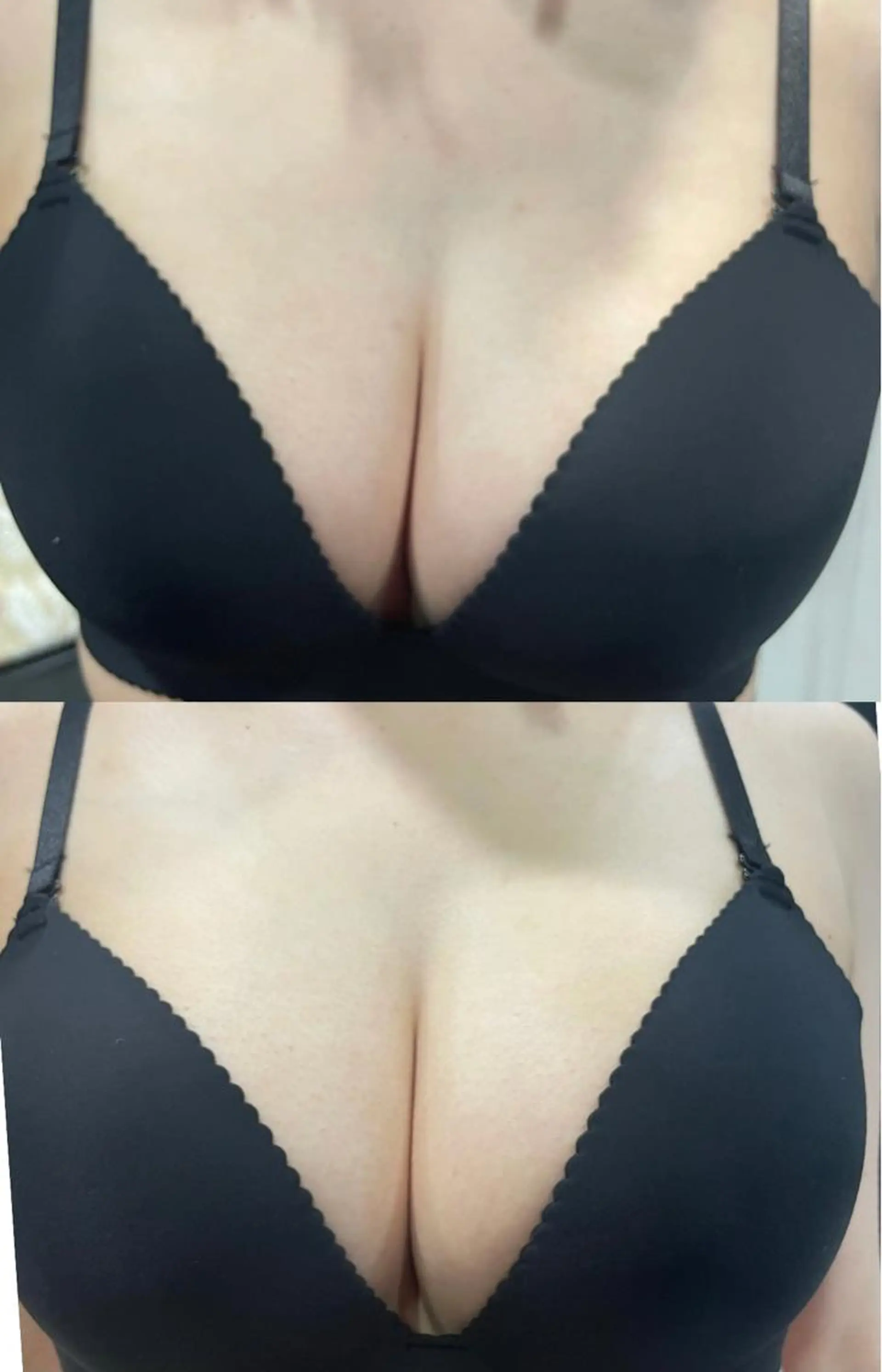 大阪脱毛|ちぇるま| 眉毛Wax｜美肌管理のエステ・リラクイメージ