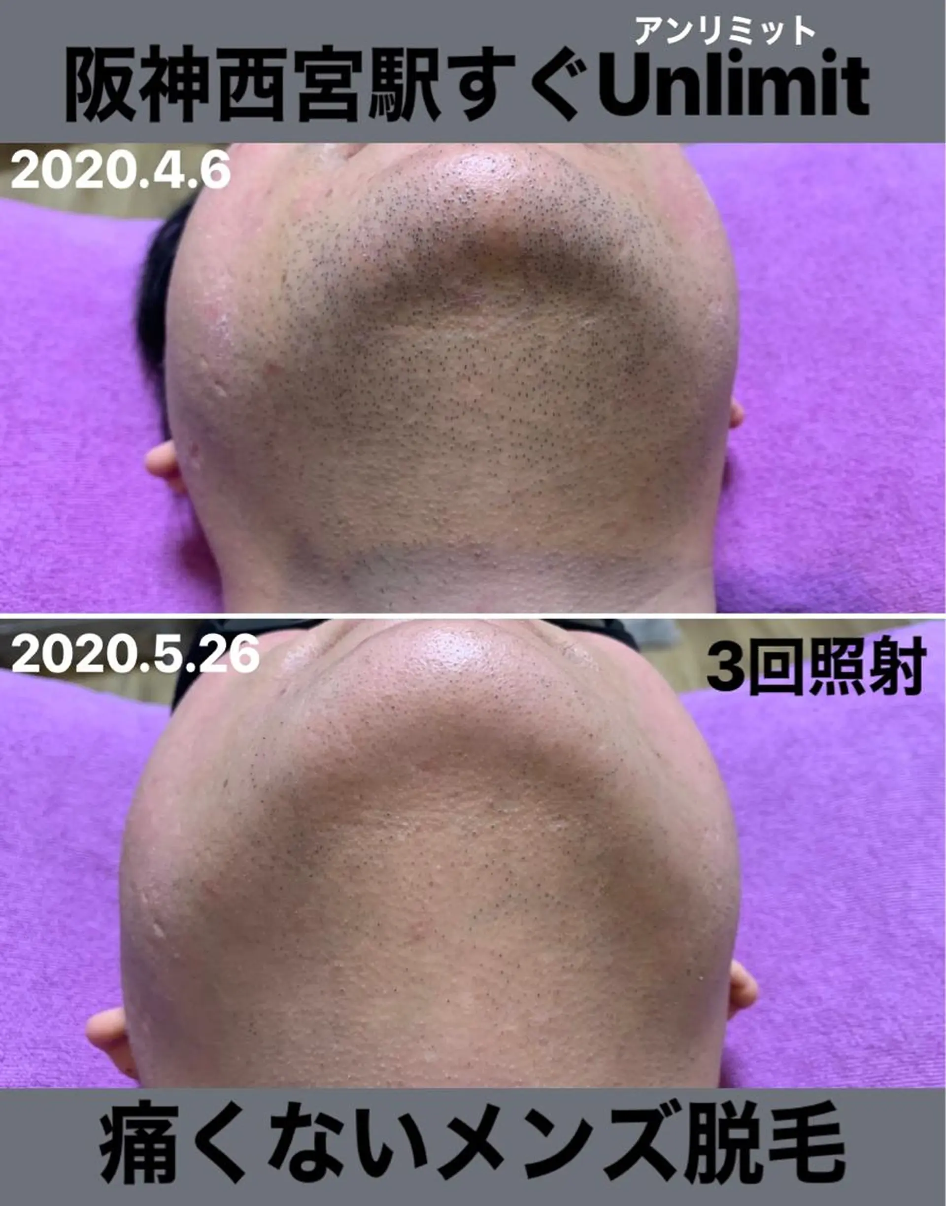 メンズ 脱毛＆エステサロン【アンリミット】所属・森谷 莉美のエステ・リラクイメージ