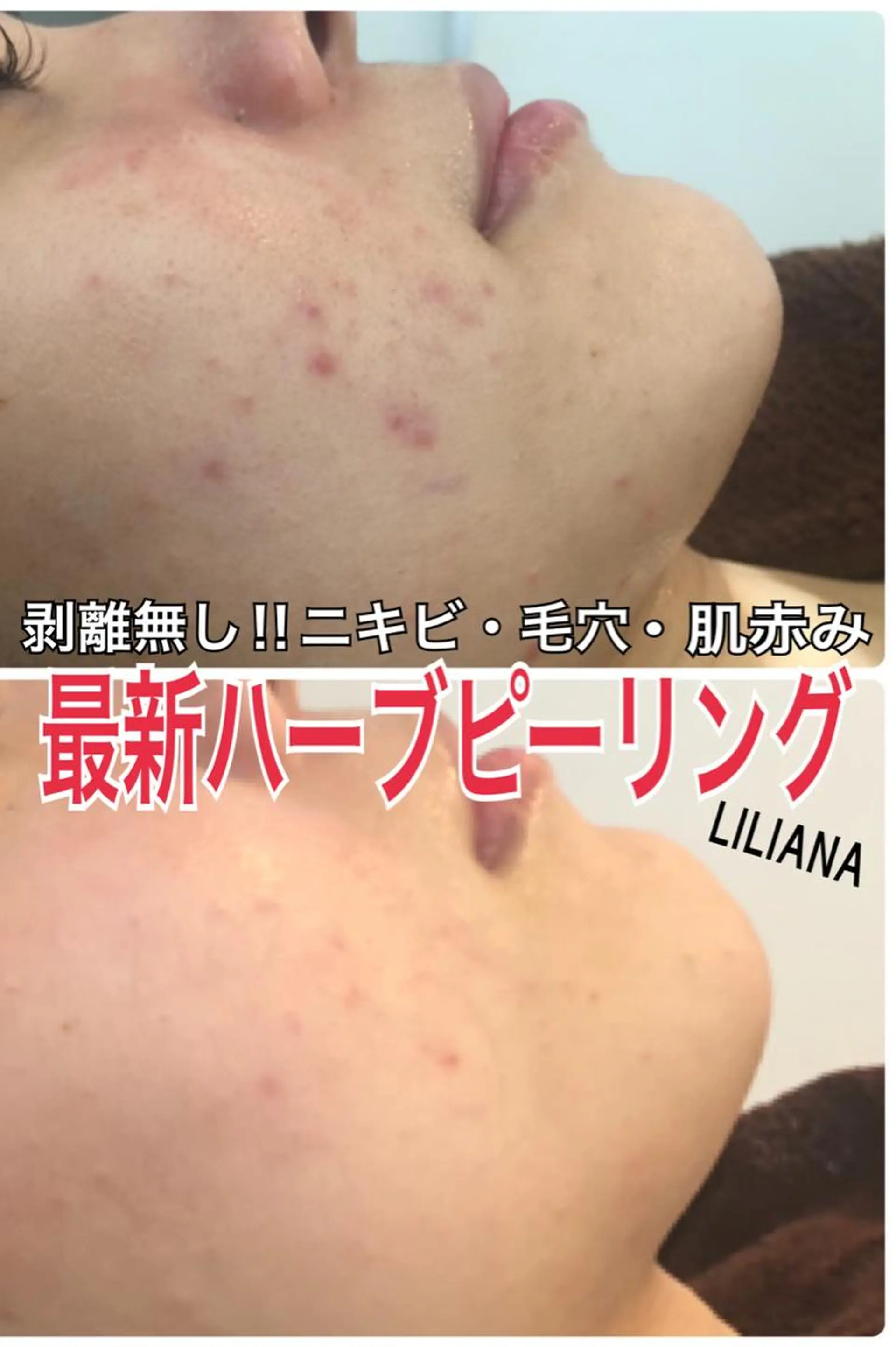 LILIANA ☆YURIのエステ・リラクイメージ