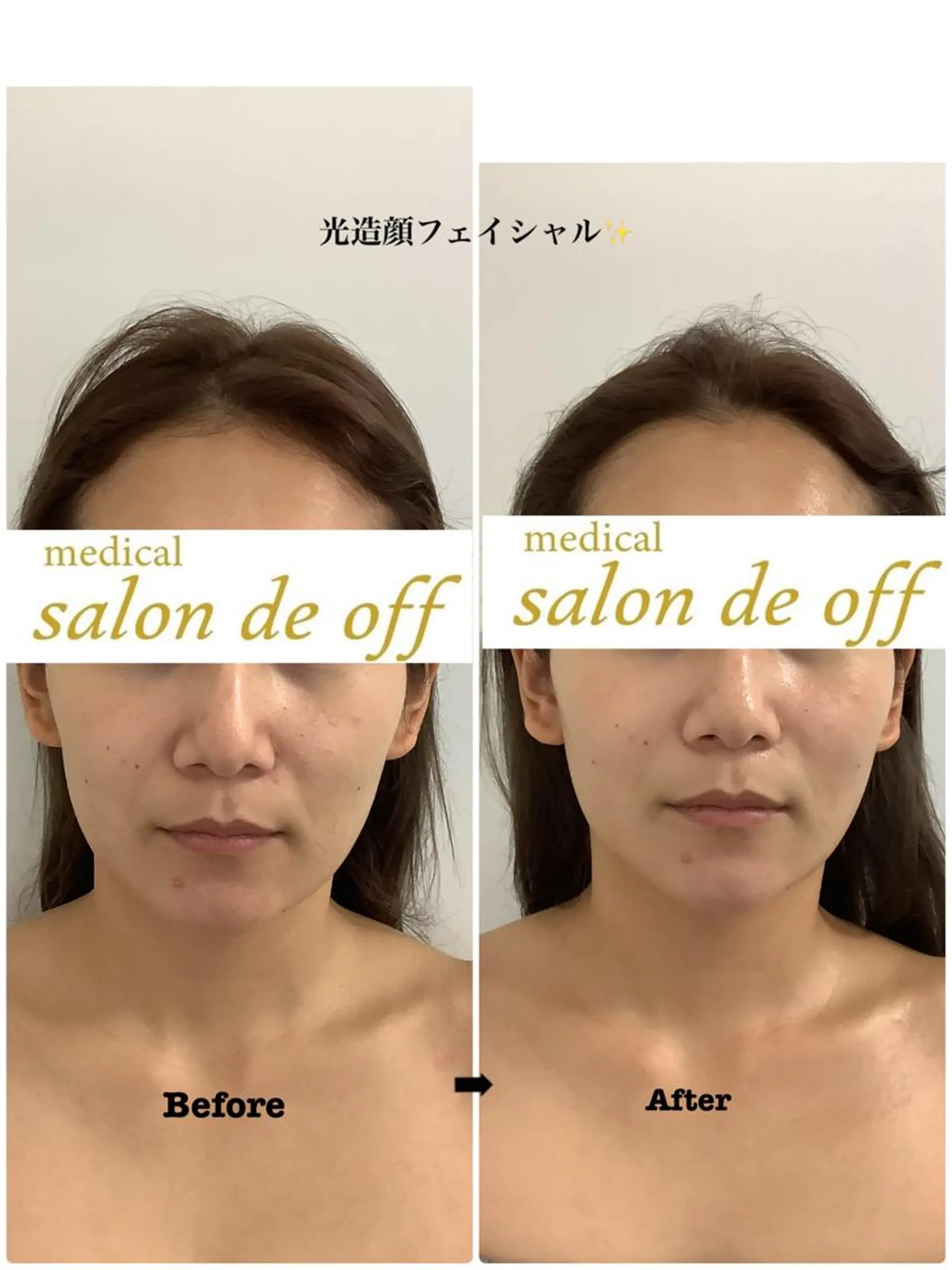 🩵Tatsumi Kana🩵のエステ・リラクイメージ