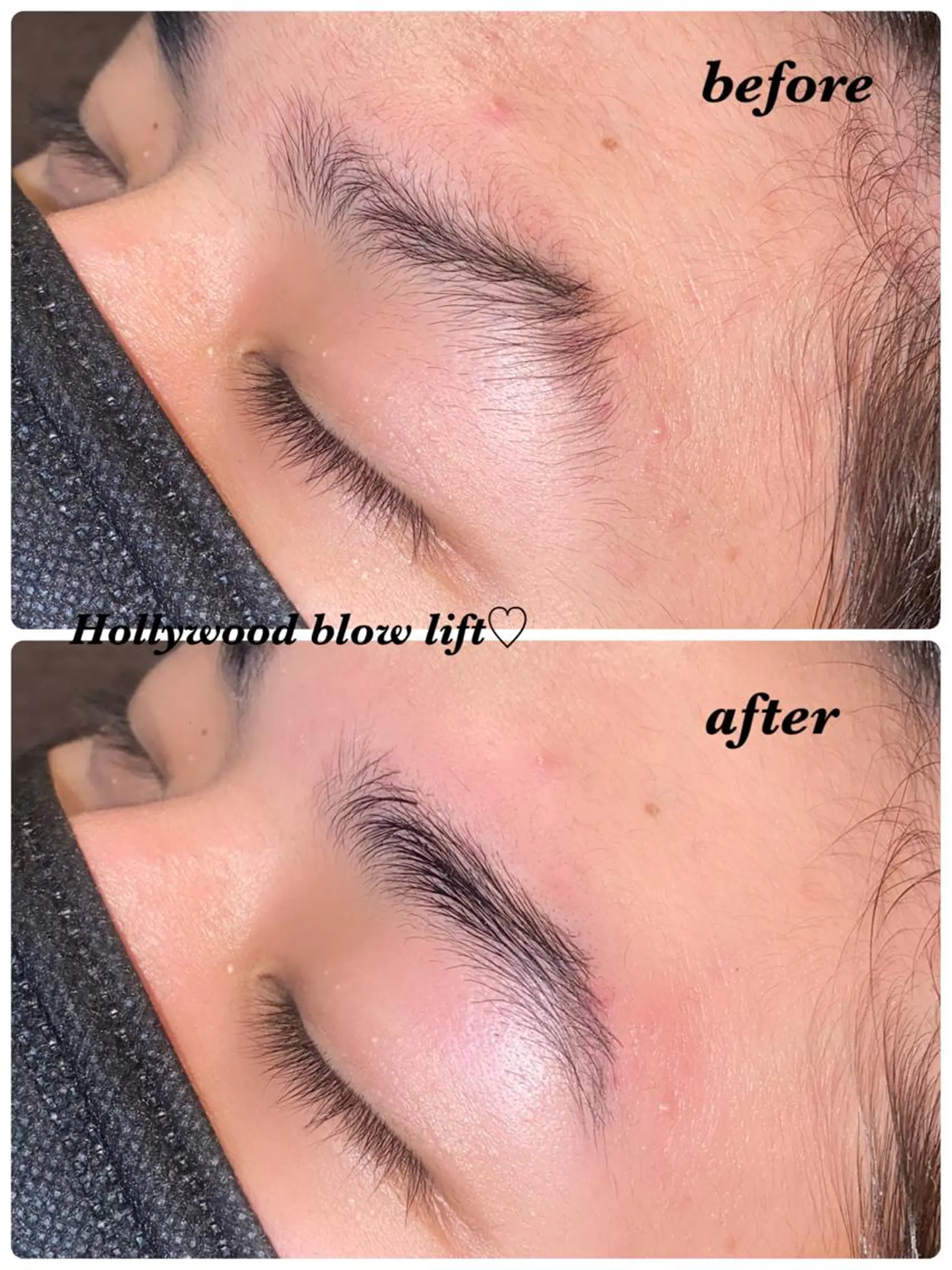 アイブロウ ハリウッドブロウリフト ハーブピーリング/韓国肌管理/フェイシャル/毛穴洗浄/眉毛/顔脱毛【糸脱毛専門】rev所属・ハーブピーリング専門 毛穴洗浄❤️眉waxのエステ・リラクイメージ