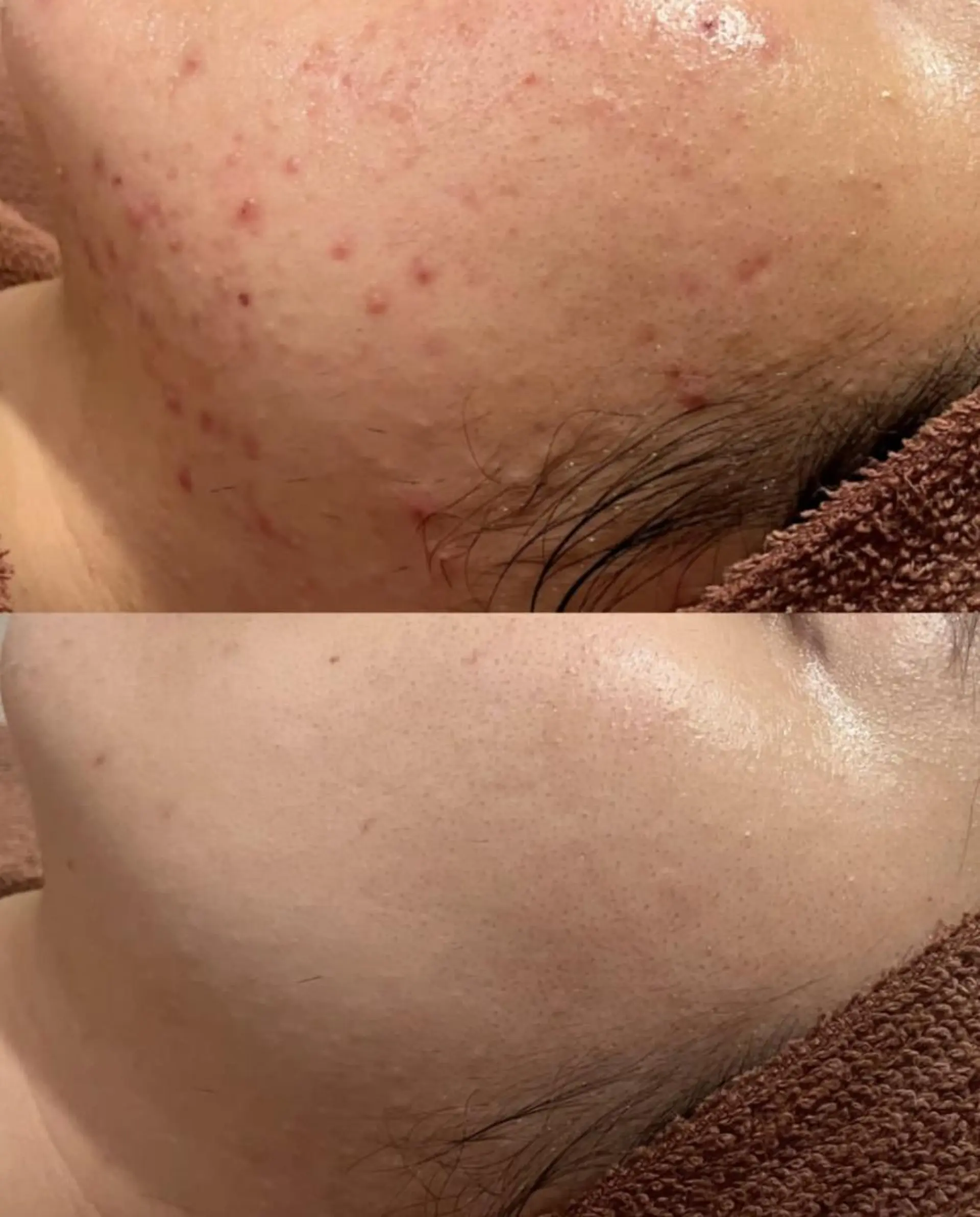 ニキビ・肌質改善専門 ♡人生が変わるサロンのエステ・リラクイメージ