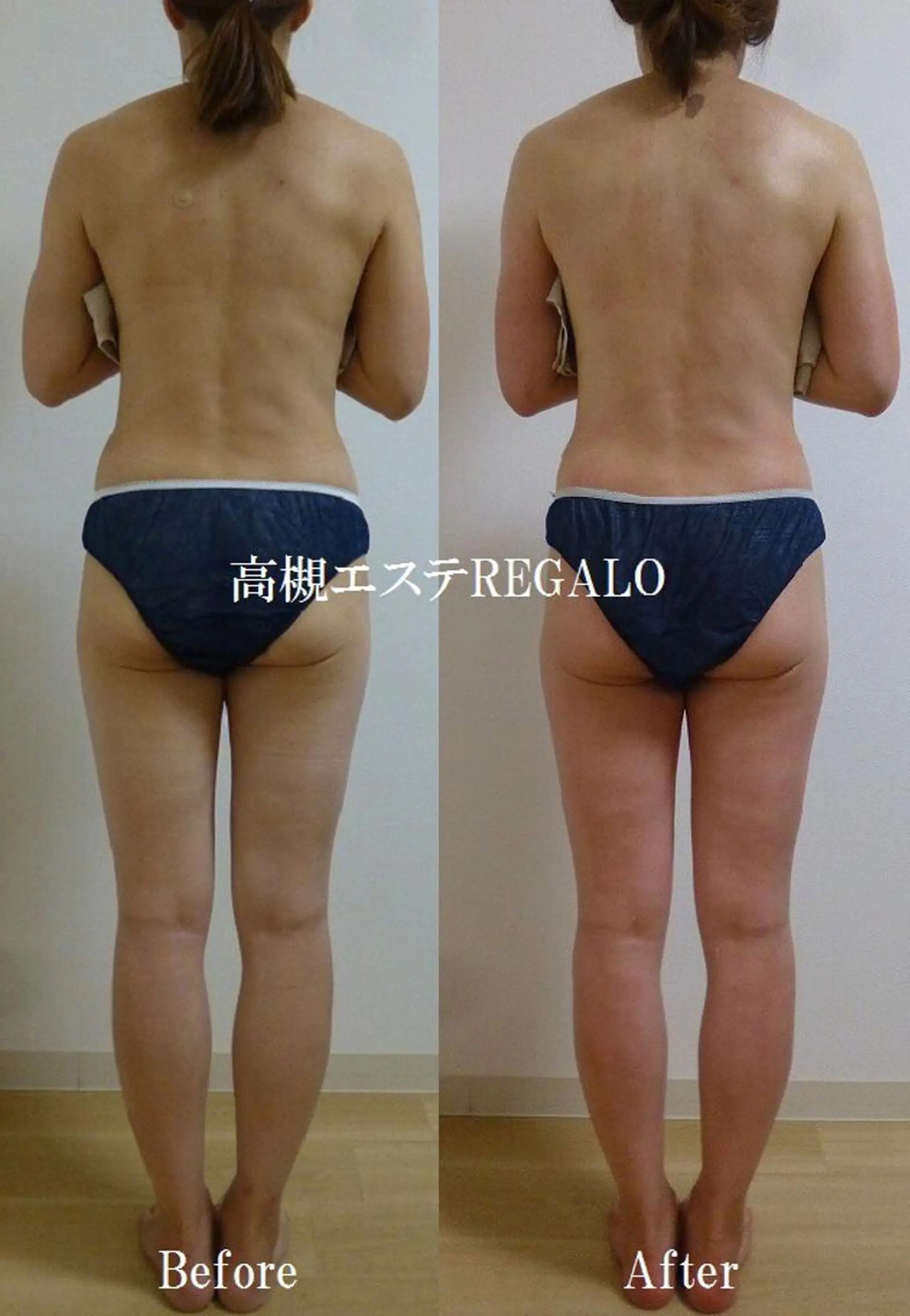 エステ REGALO所属・矢野 さやかのエステ・リラクイメージ