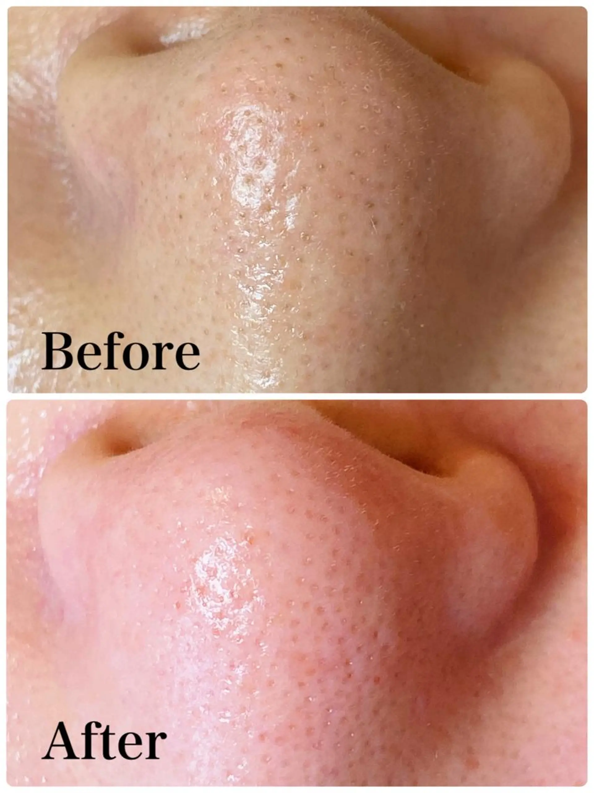 多摩境ViVi chinamiのエステ・リラクイメージ