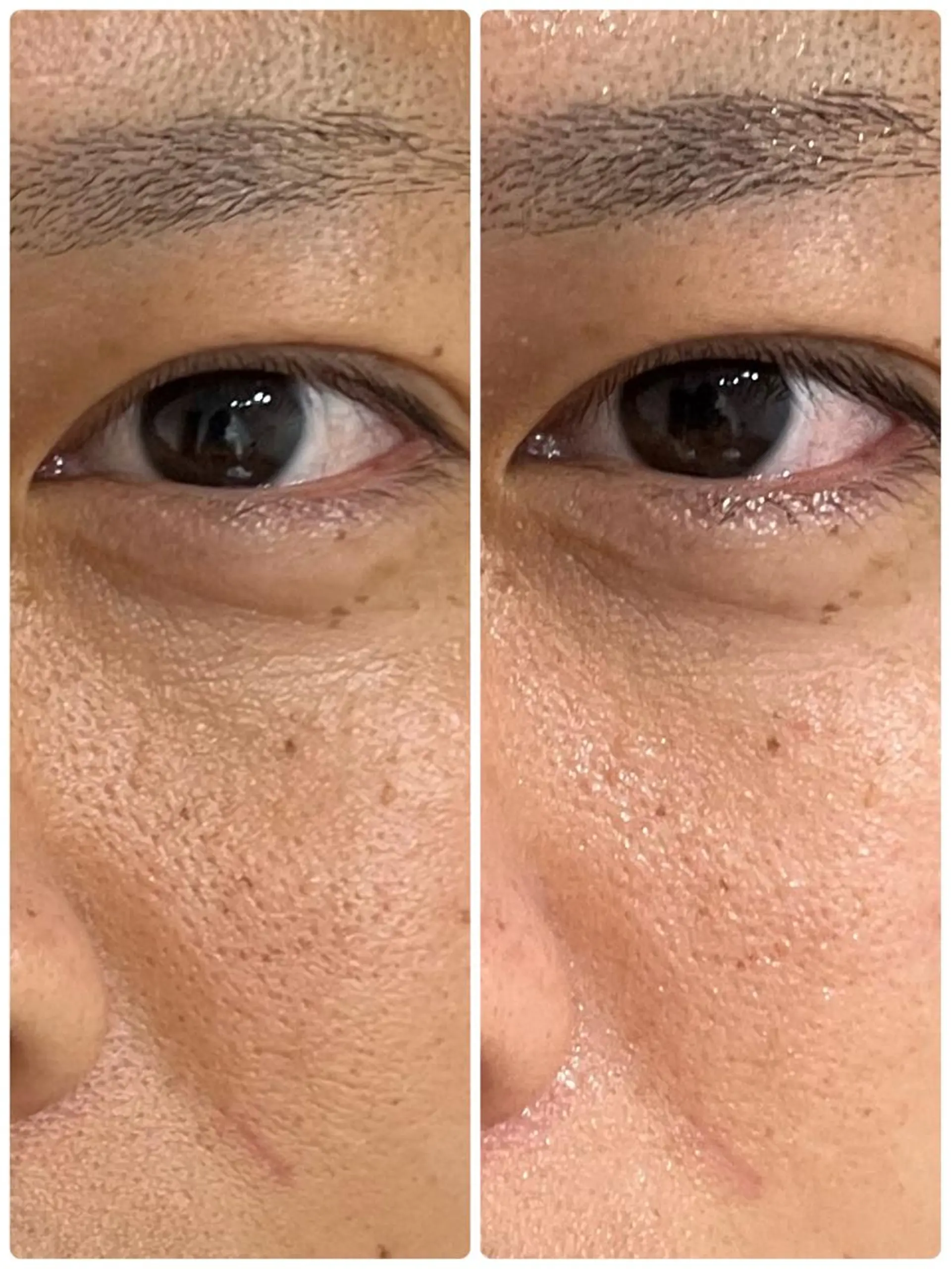 小顔・ツルツル素肌 ハリステリアのエステ・リラクイメージ