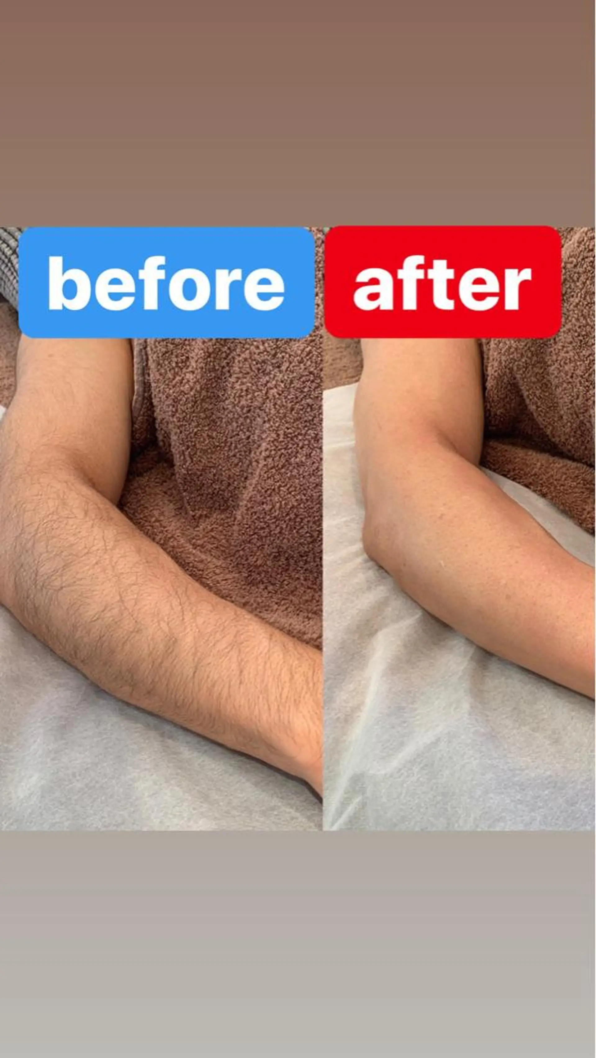 メンズ BRUSH  BODY所属・男性施術者による 光脱毛×ワックス脱毛のエステ・リラクイメージ