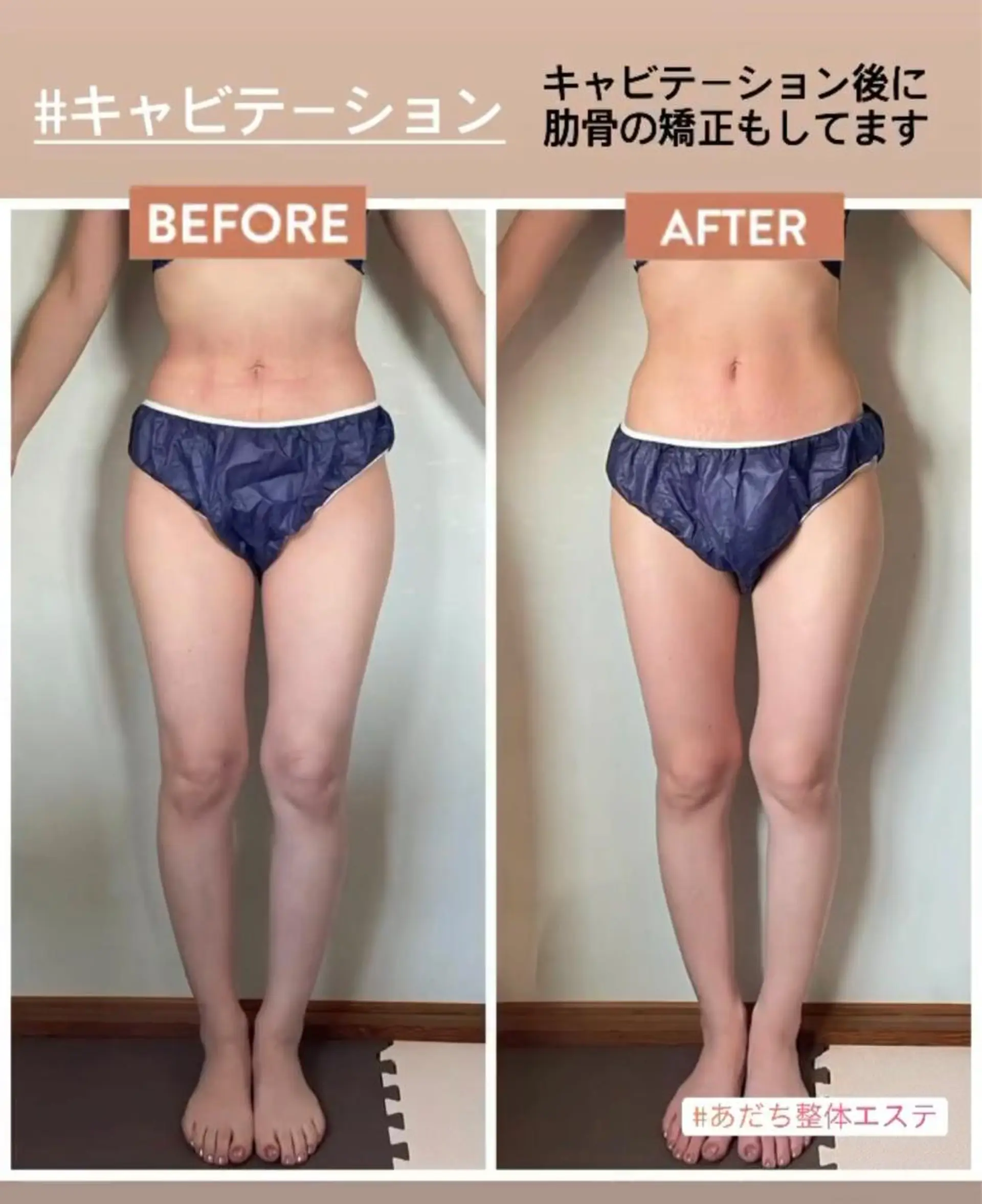 あだち整体エステ 首肩背中のゆるめぐのエステ・リラクイメージ