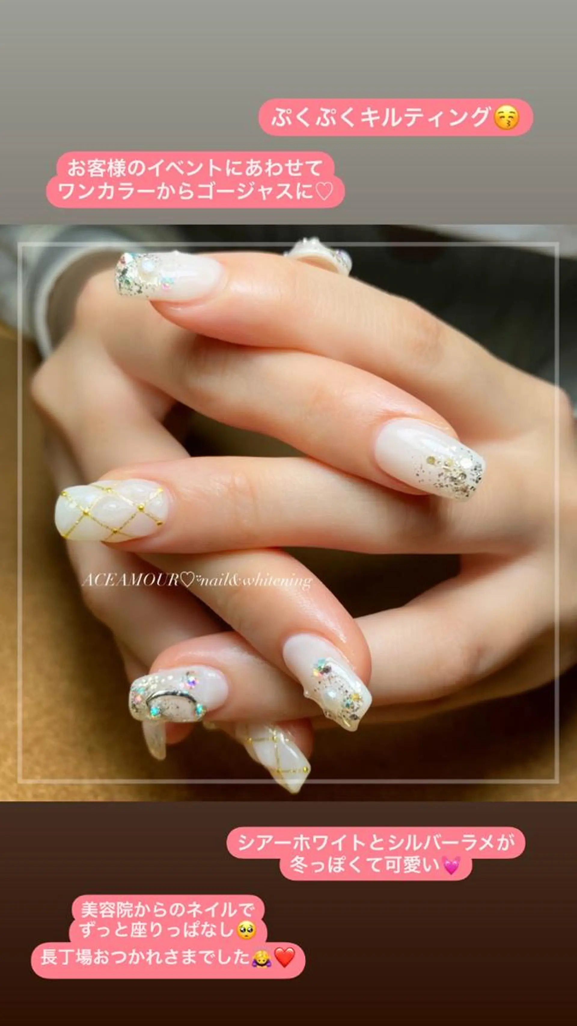 ネイル ぷっくりネイル ネイル/耳つぼ /新ホワイトニングのネイルデザイン