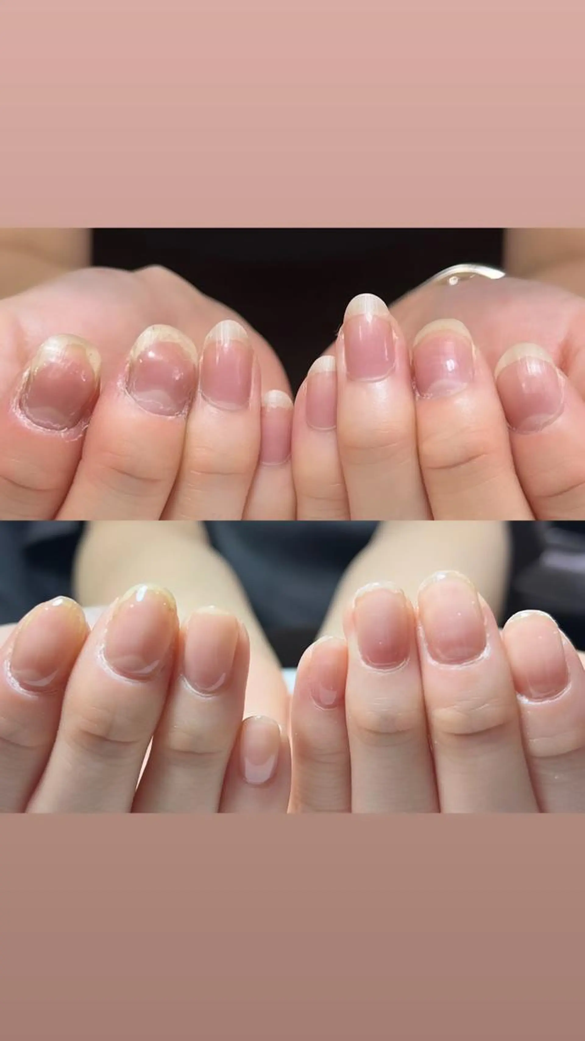 ネイル 自爪育成・巻き爪 補正講師　津蔵のネイルデザイン