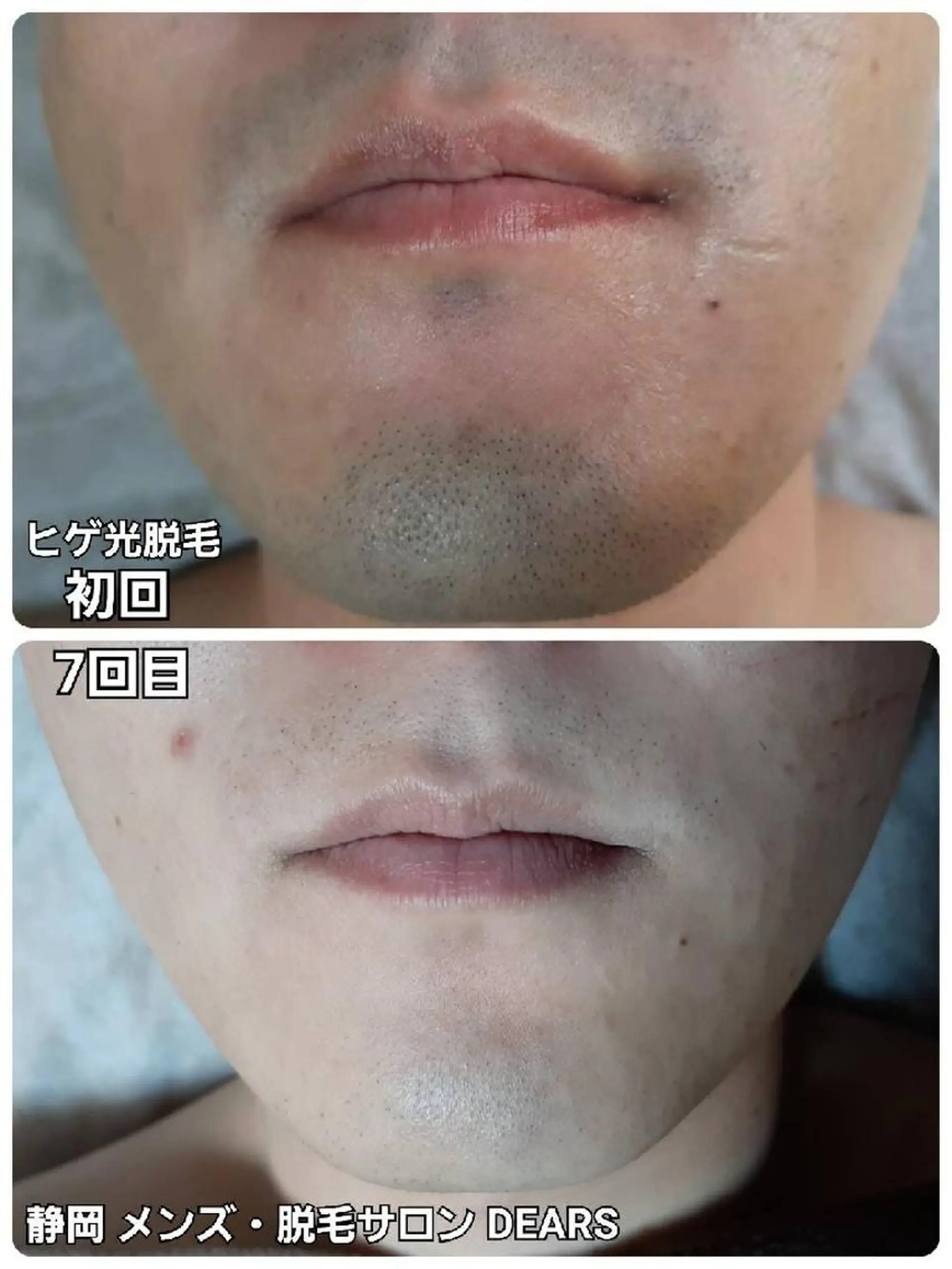 メンズ メンズ・脱毛サロン DEARS所属・山村幸久　メンズ脱毛 ディアーズのエステ・リラクイメージ