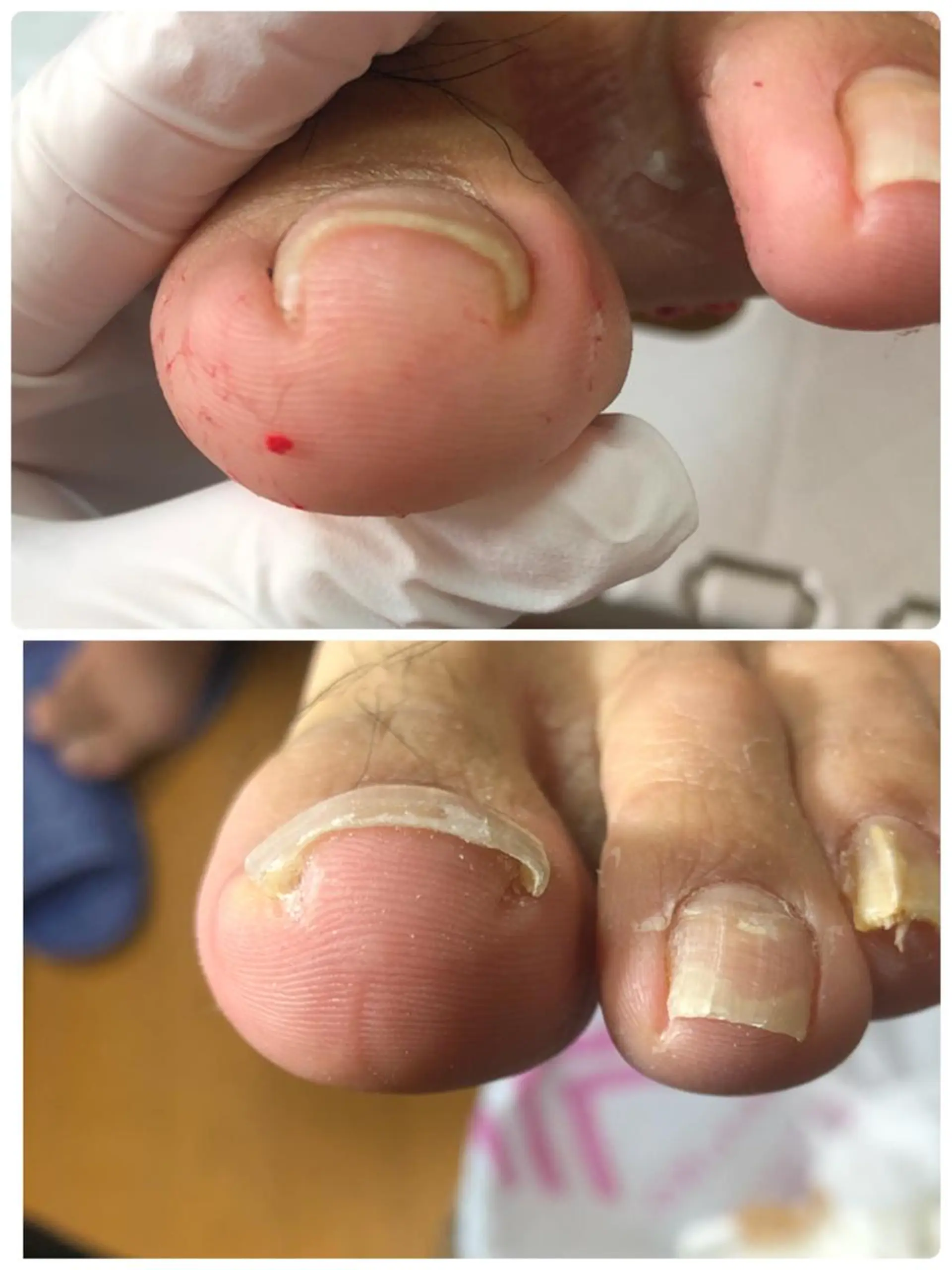 ネイル ❤︎MN❤︎ モンのエステ・リラクイメージ