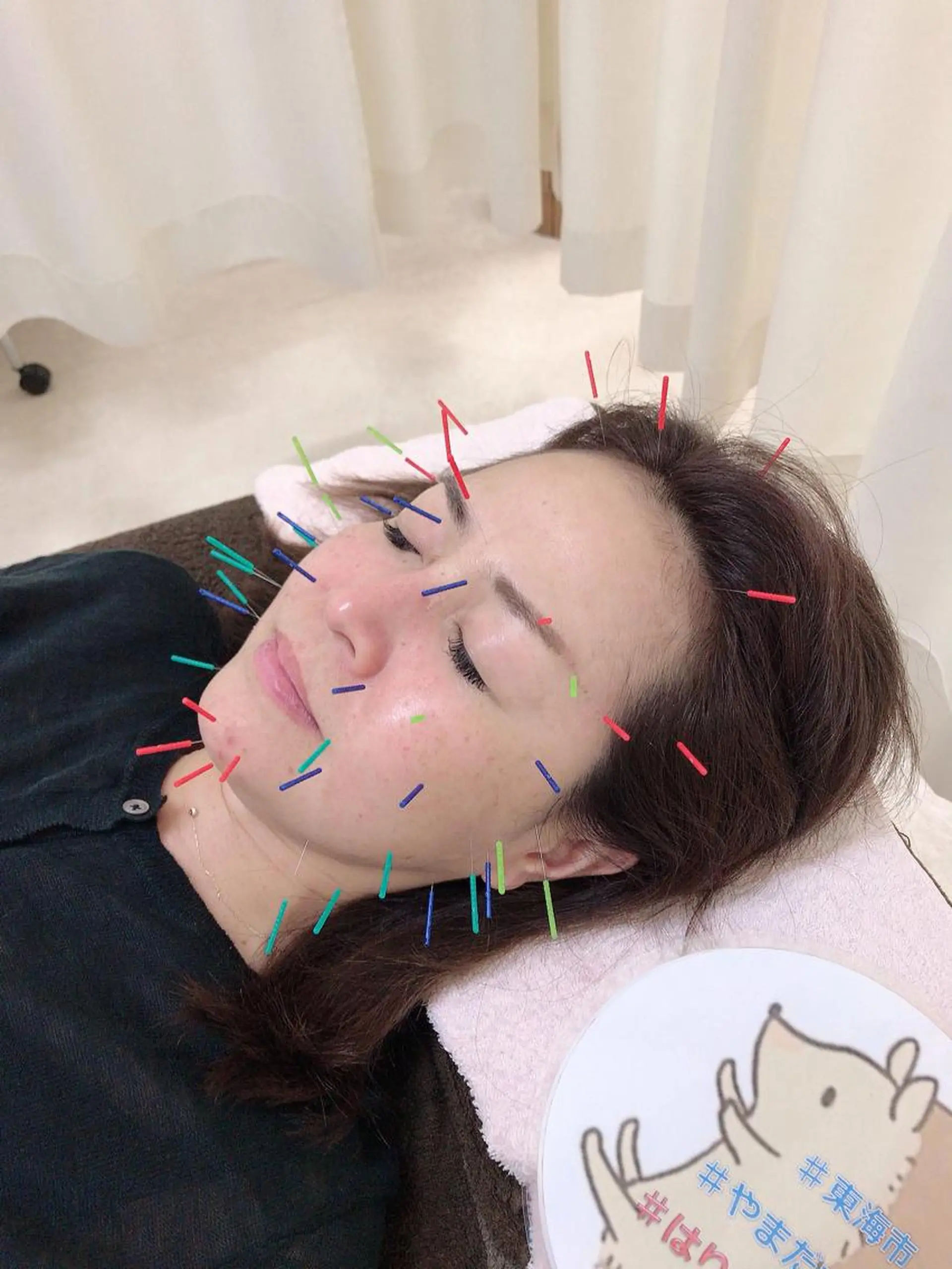 その他 やまだ鍼灸接骨院（やまだしんきゅうせっこついん）所属・山田 晃のエステ・リラクイメージ