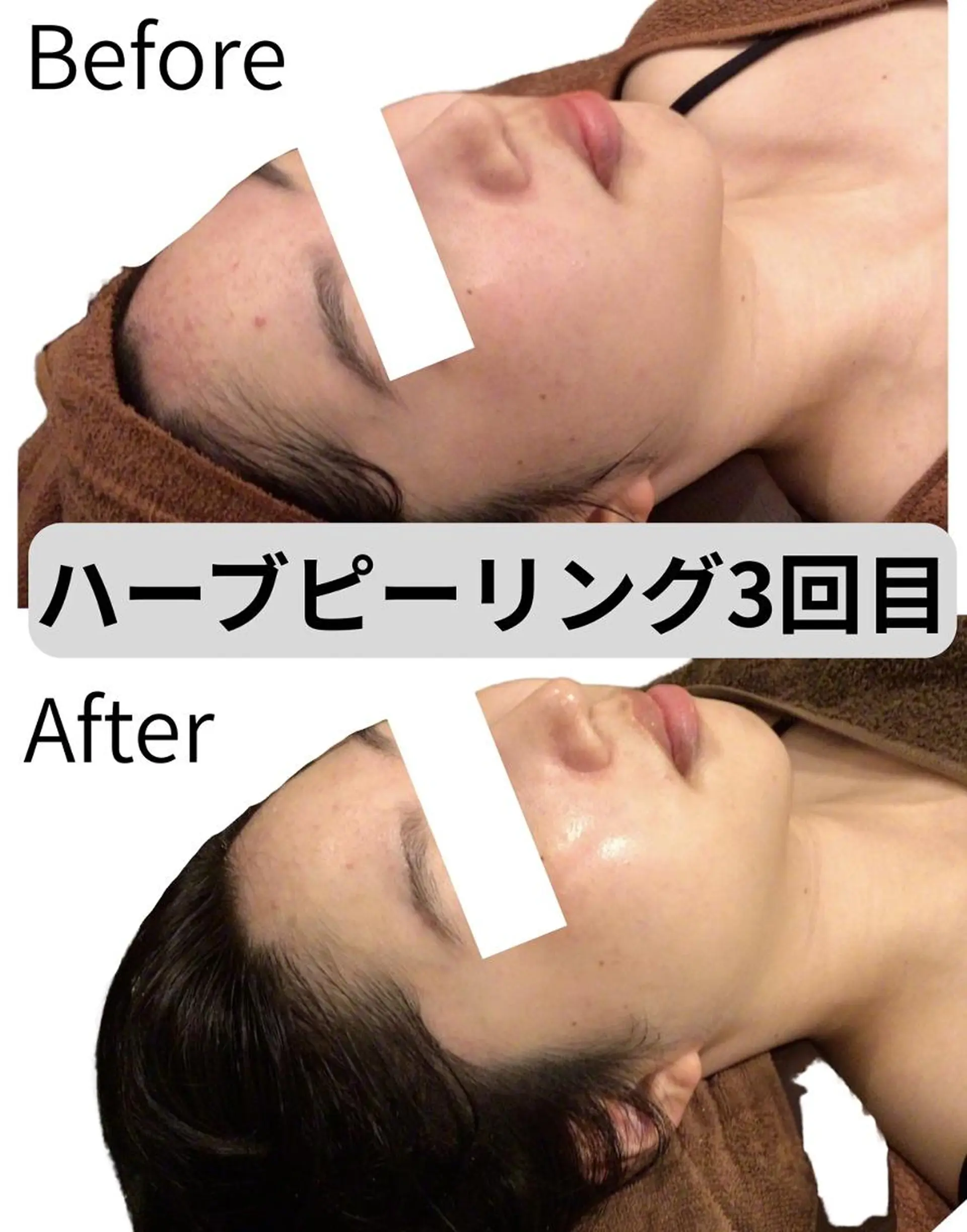 エステ 美容鍼・整体サロン アネモネ🌸心斎橋のエステ・リラクイメージ