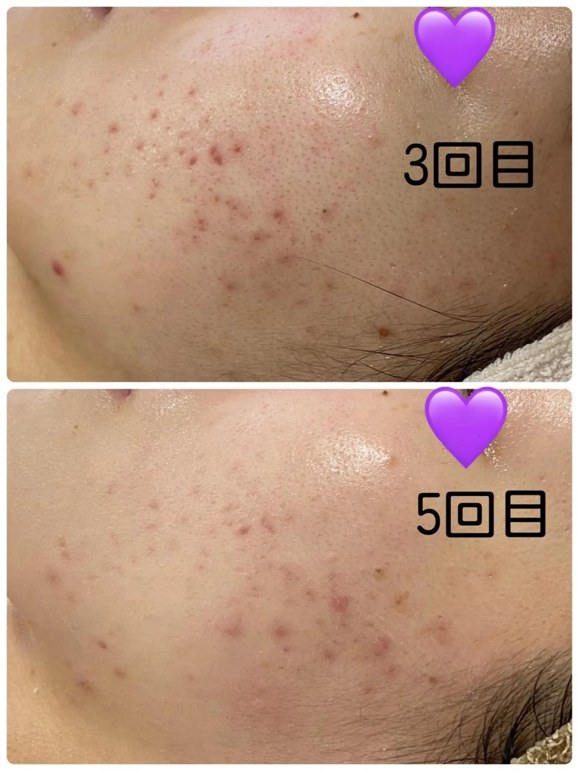 エステ COCO beautyサロンのエステ・リラクイメージ