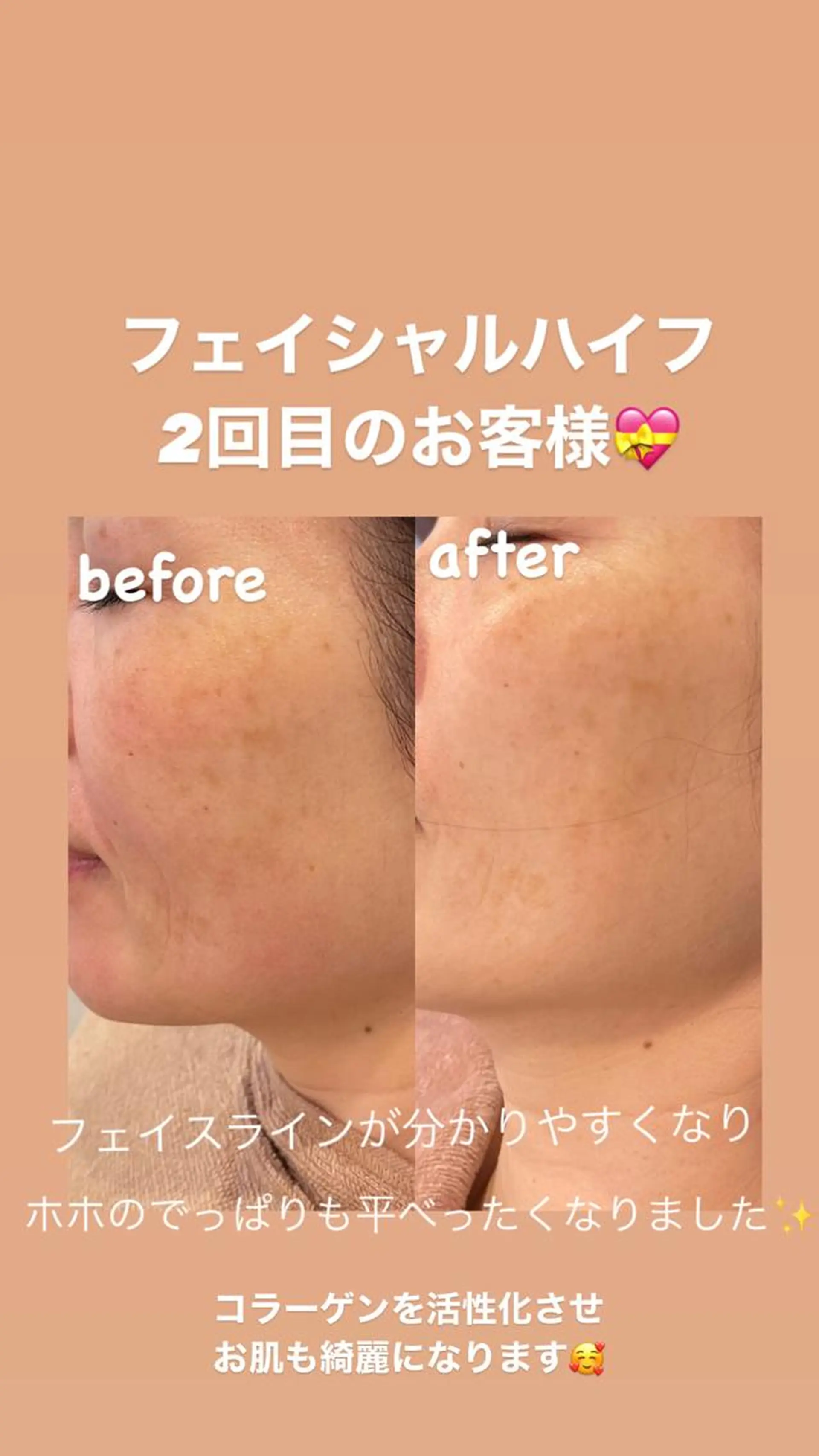 VERY VERY 九条店のエステ・リラクイメージ