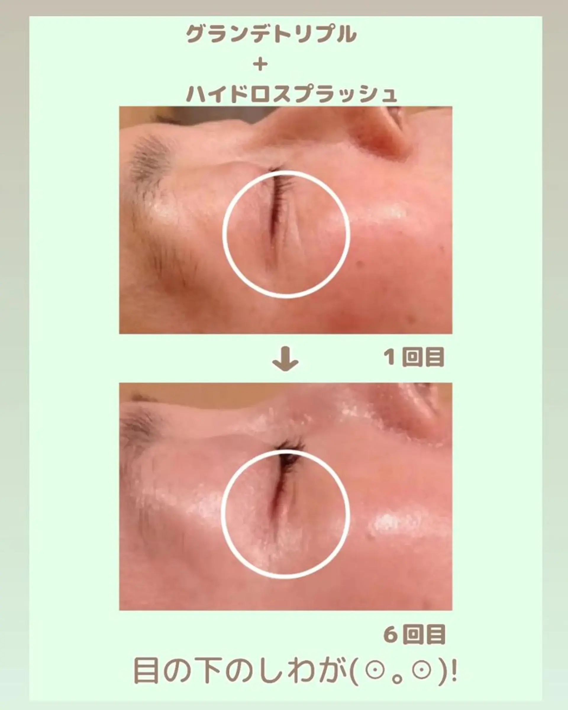 ラブニール 恵比寿店のエステ・リラクイメージ