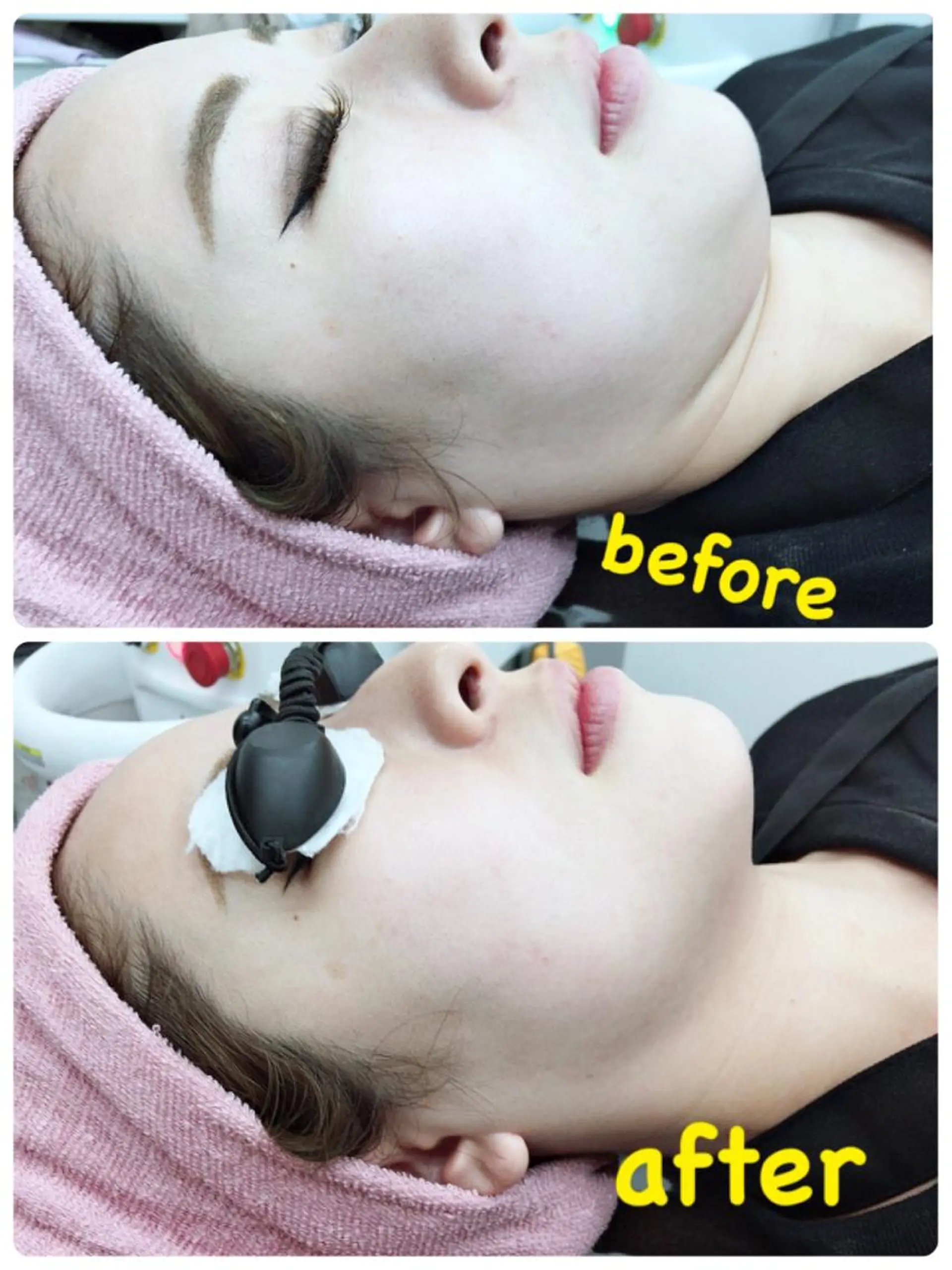 ハーブピーリングMB eautySalonのエステ・リラクイメージ