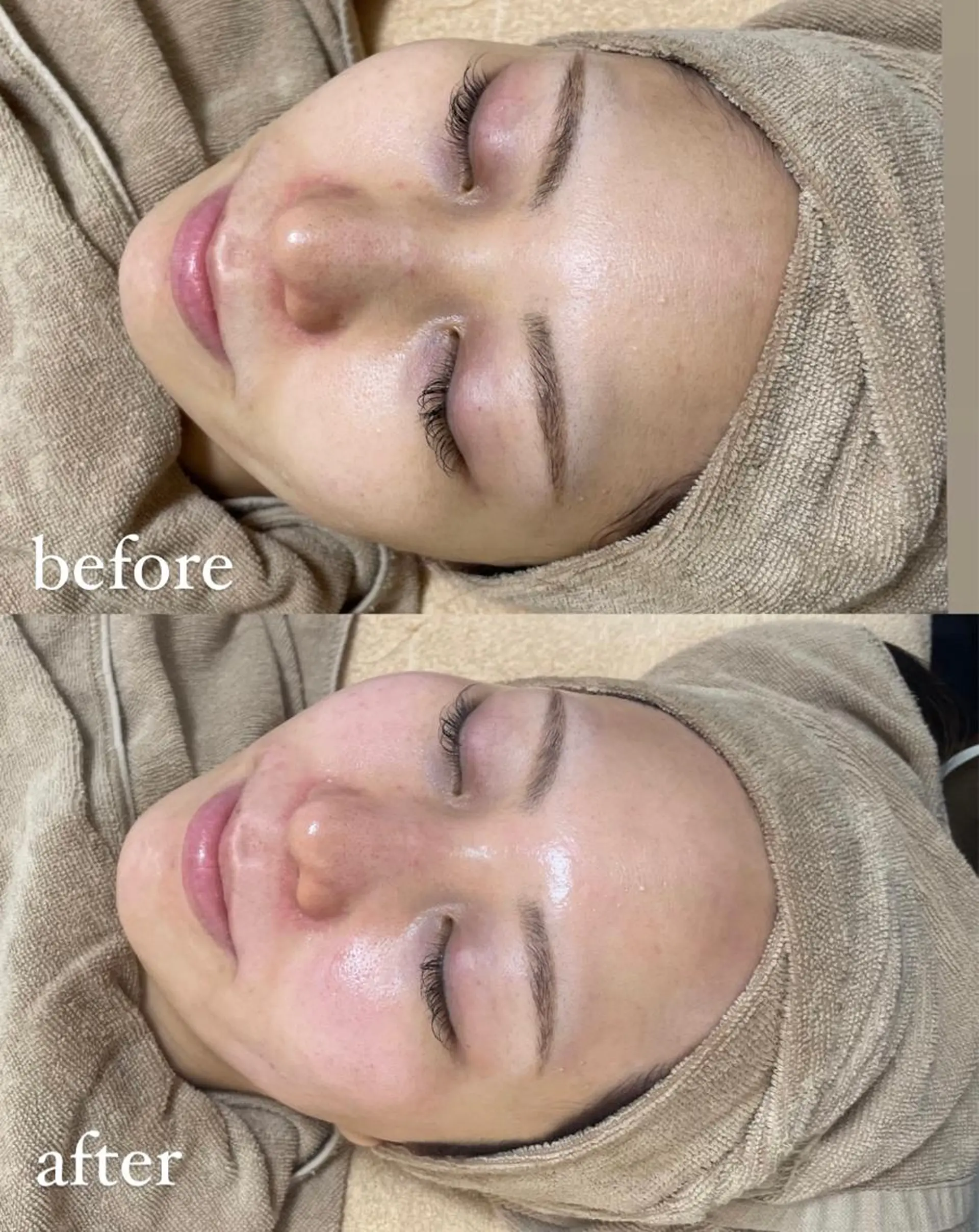 脱毛 エステサロン Mi-mi.iのエステ・リラクイメージ