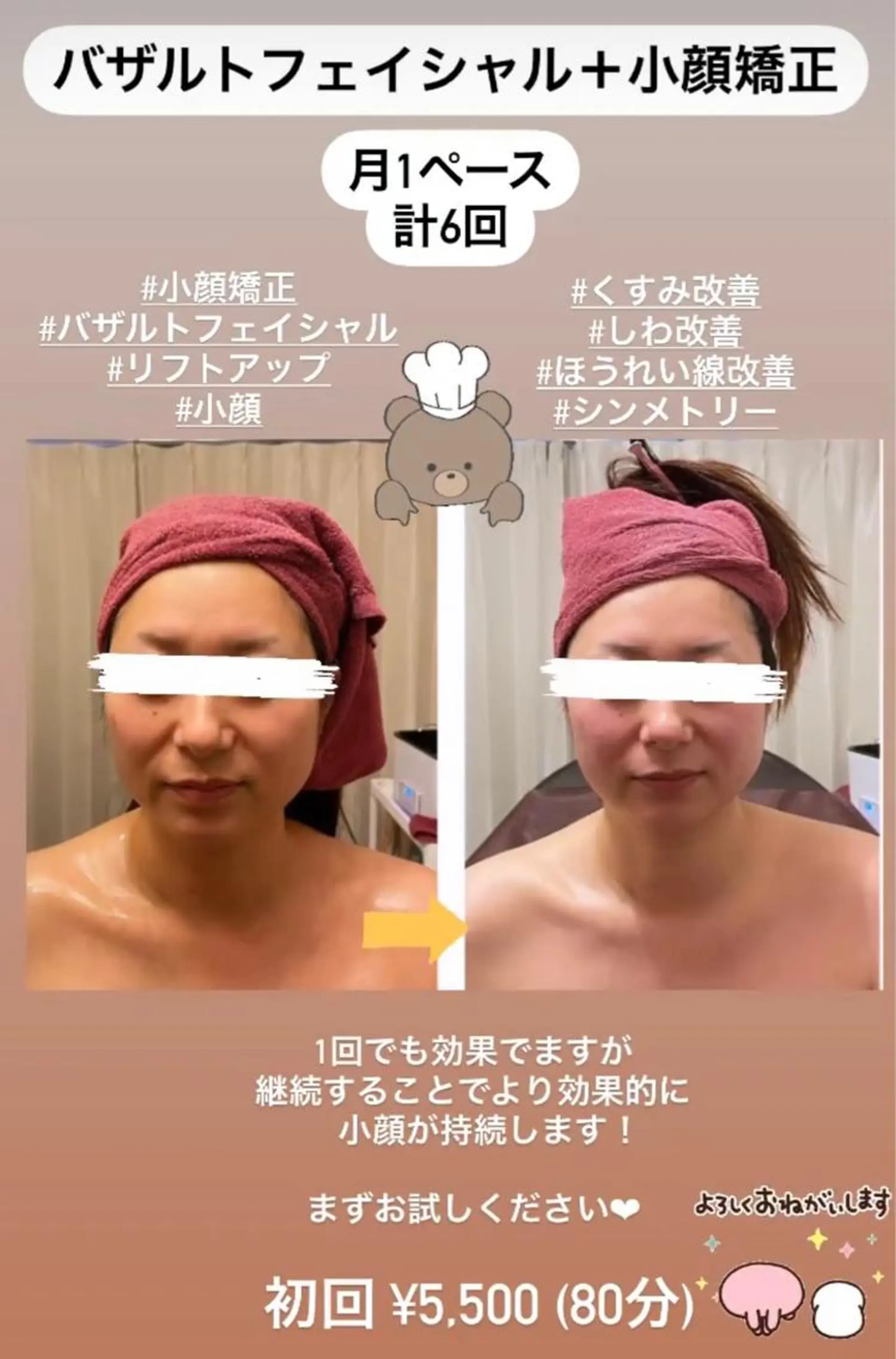 エステ 35歳からの エイジングケアサロンのエステ・リラクイメージ