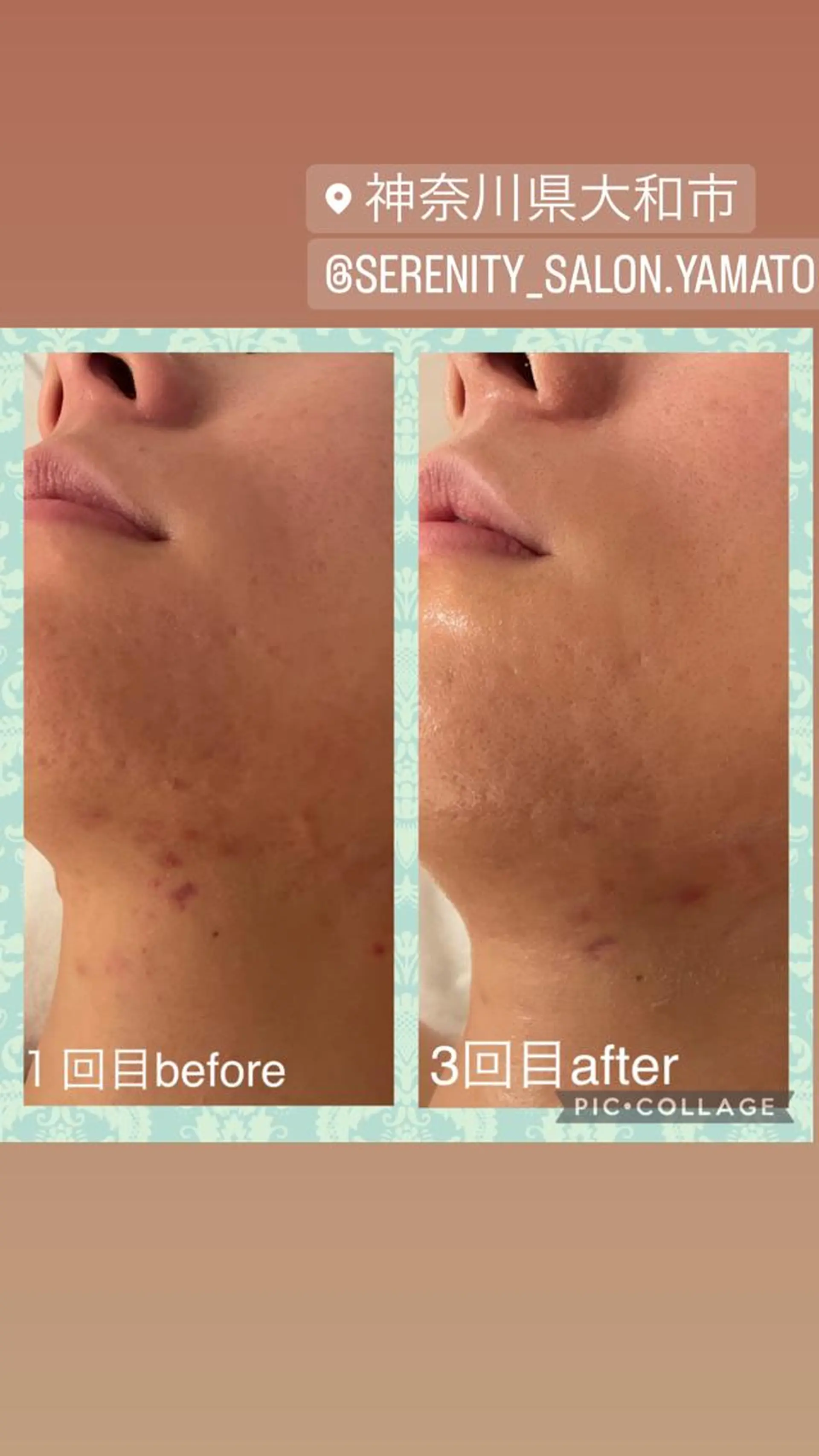 Serenity salonのエステ・リラクイメージ