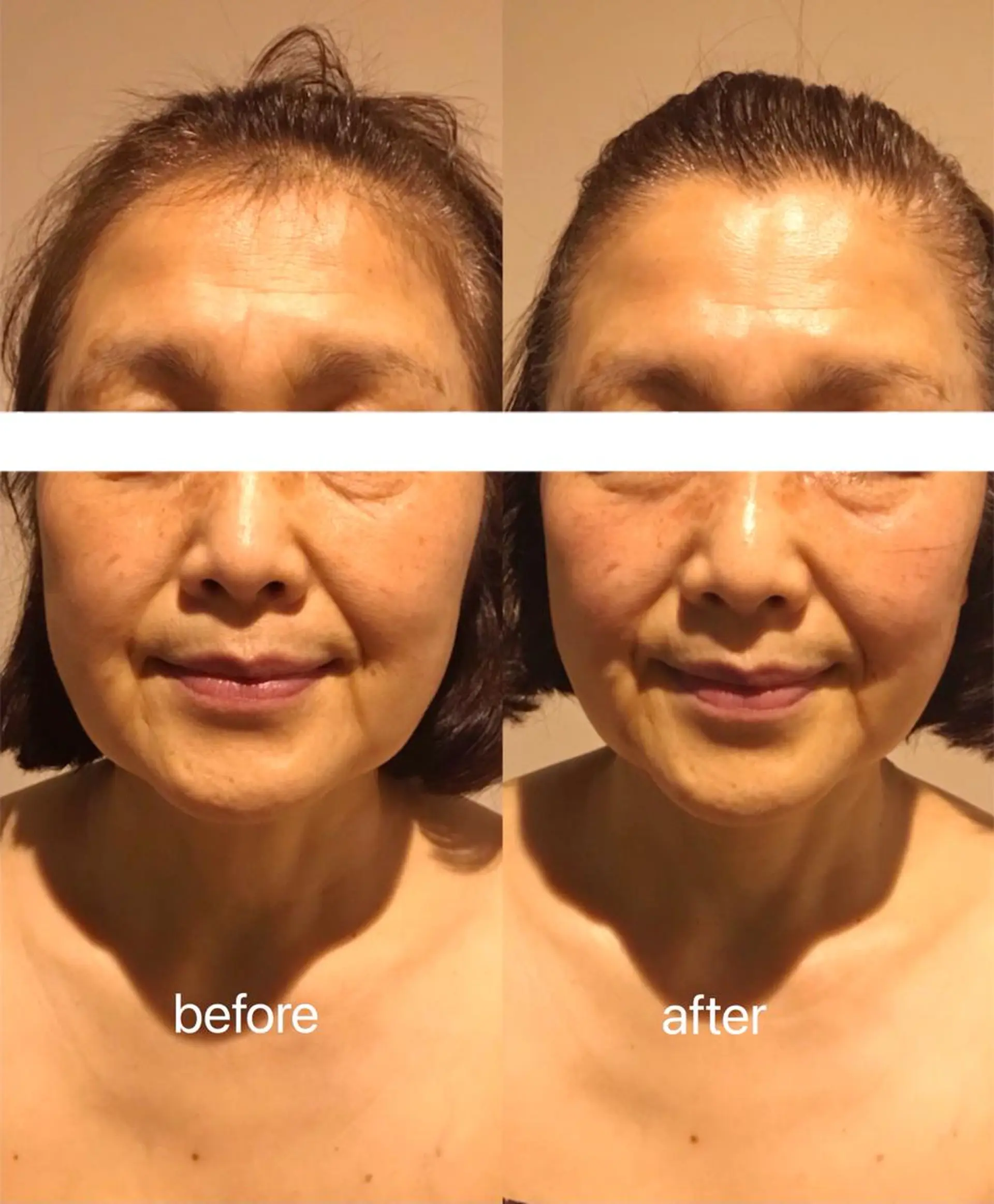 エステ マスカットサロン所属・マスカットサロン 小野寺のエステ・リラクイメージ