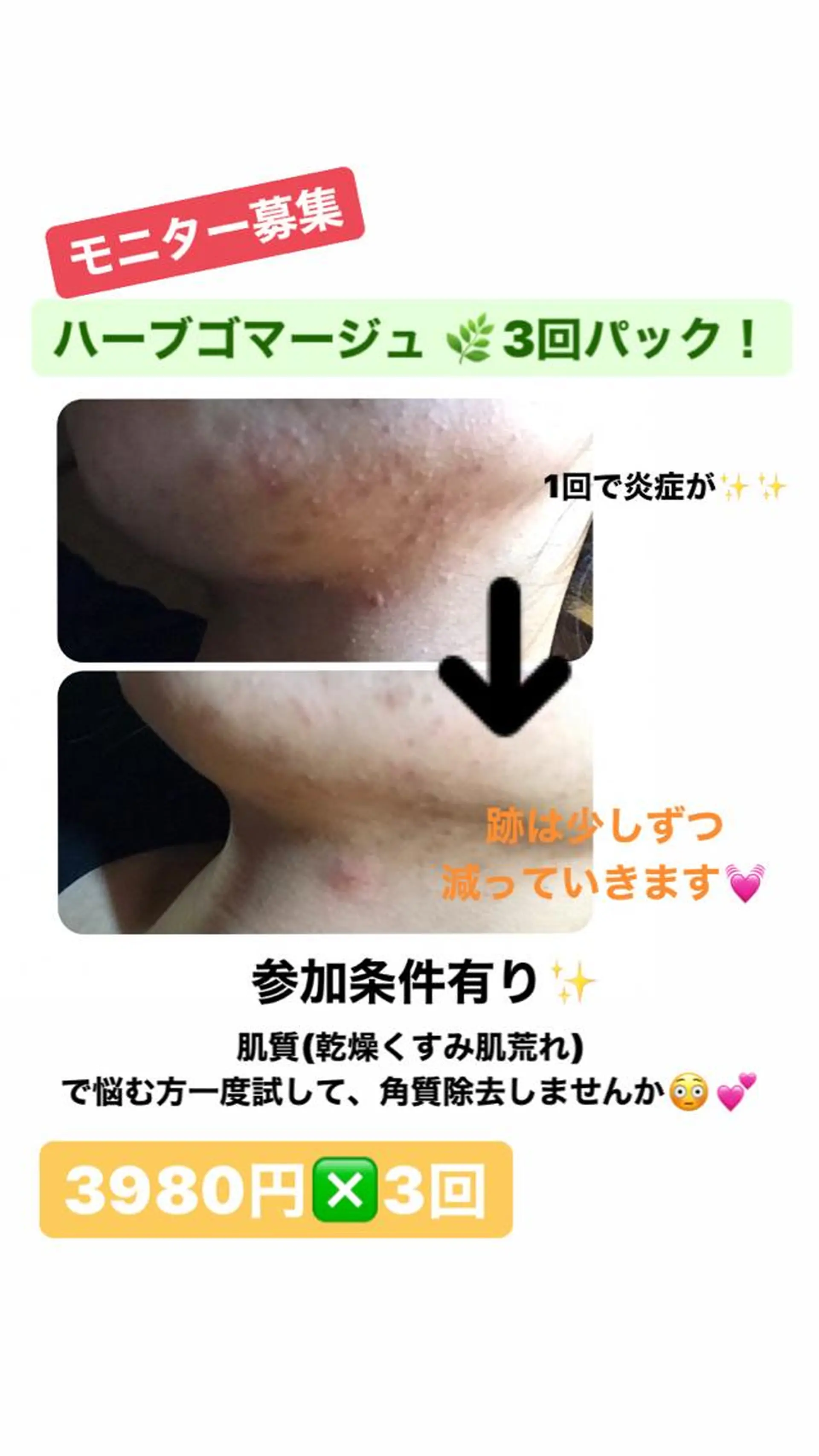 【足圧】鬼👹リンパ 身体整うサロンのエステ・リラクイメージ