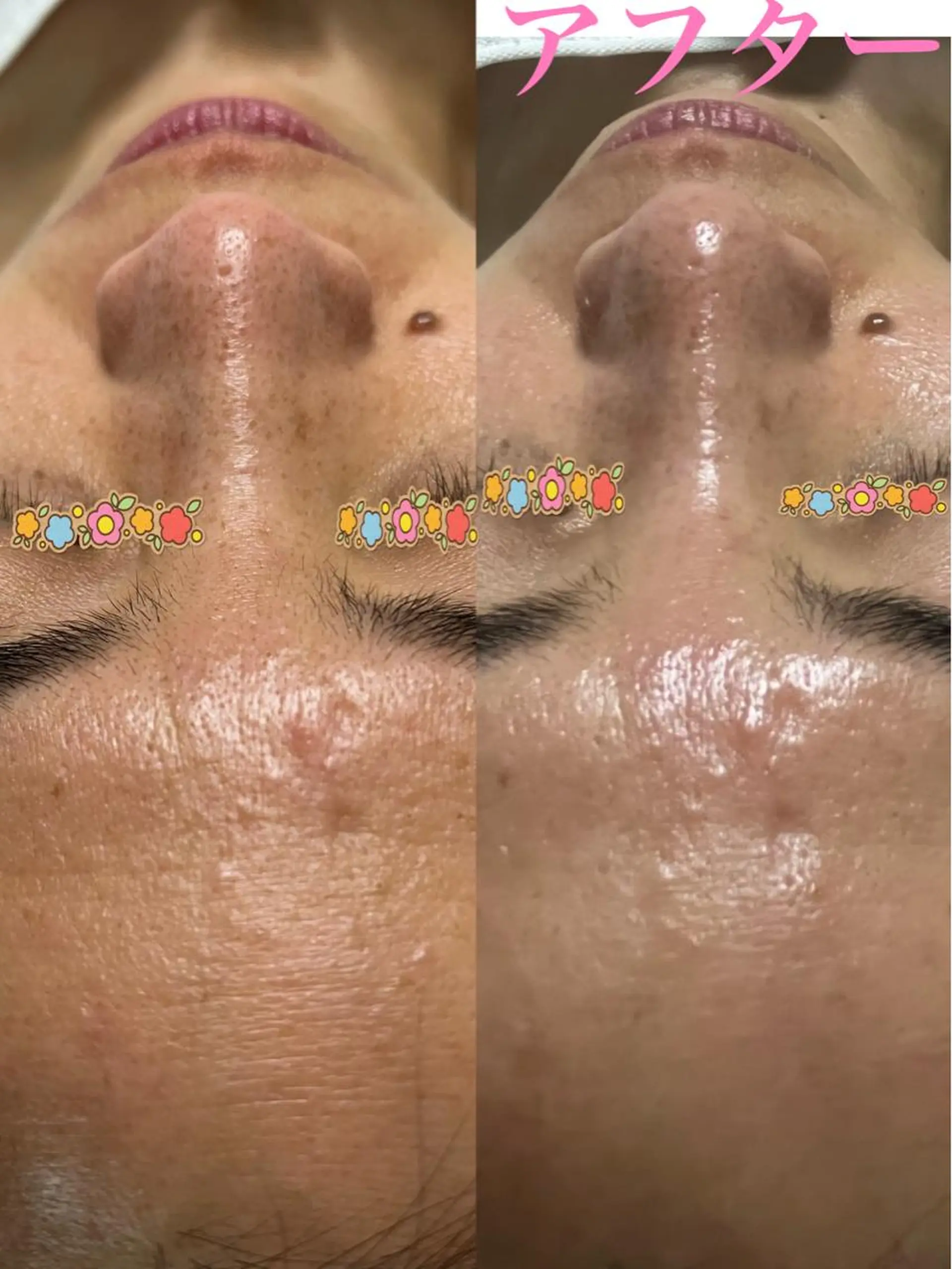 うえつま ふみえのエステ・リラクイメージ