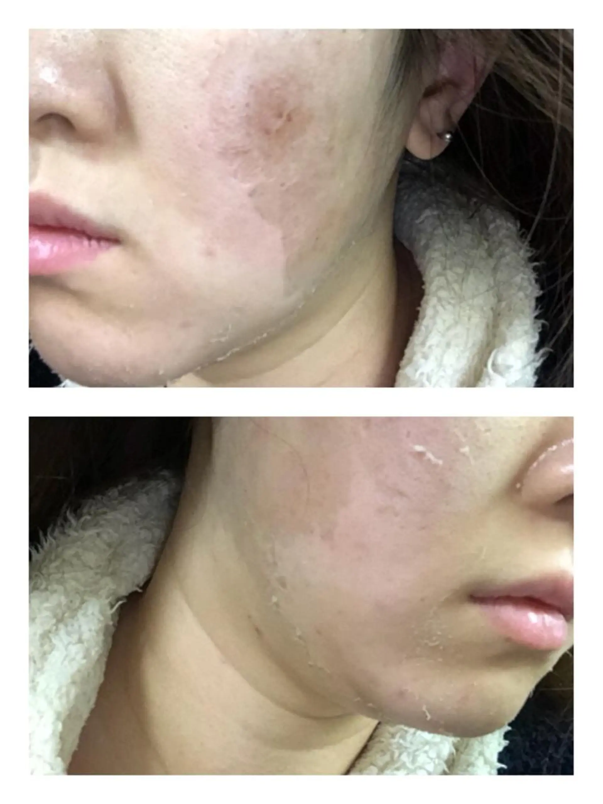 エステ 【リベルハーブピーリング認定店】敏感肌・美白脱毛専門店Dione立川店所属・Dione 立川店のエステ・リラクイメージ