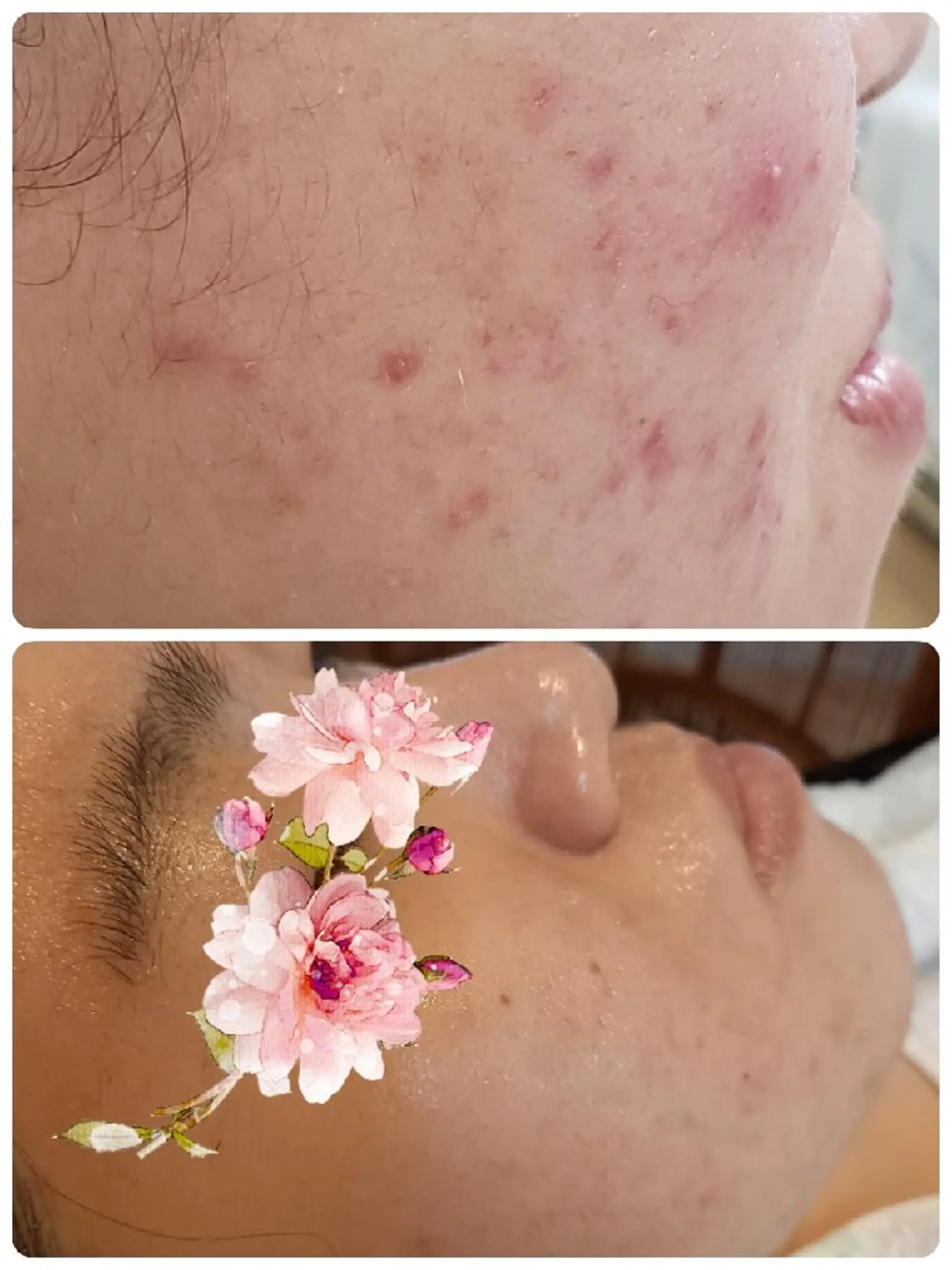 ユテラ 佑來（ゆき）のエステ・リラクイメージ