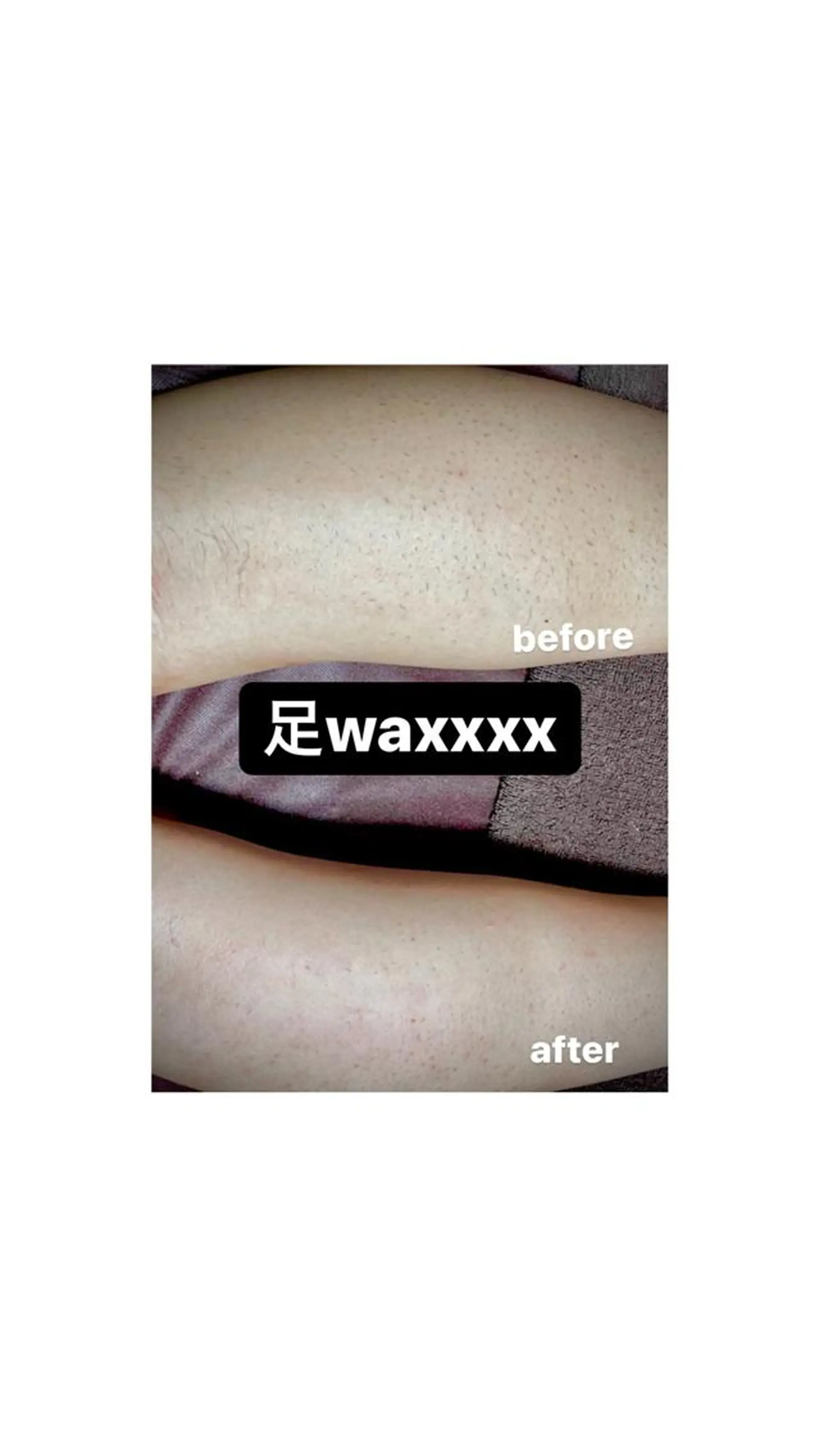 脱毛 Epina 千葉店 【エピナ】のエステ・リラクイメージ