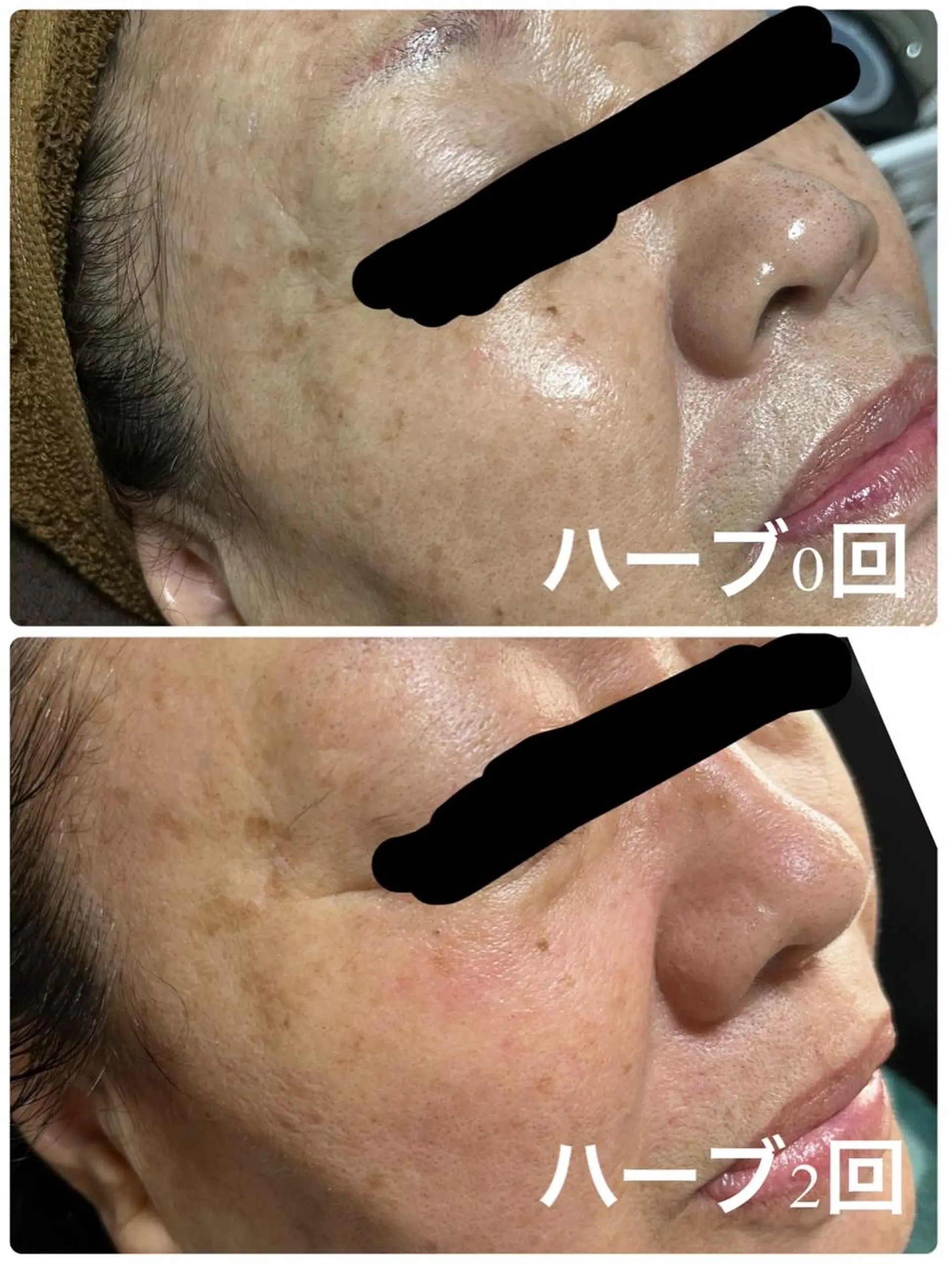 SALON BioBioのエステ・リラクイメージ