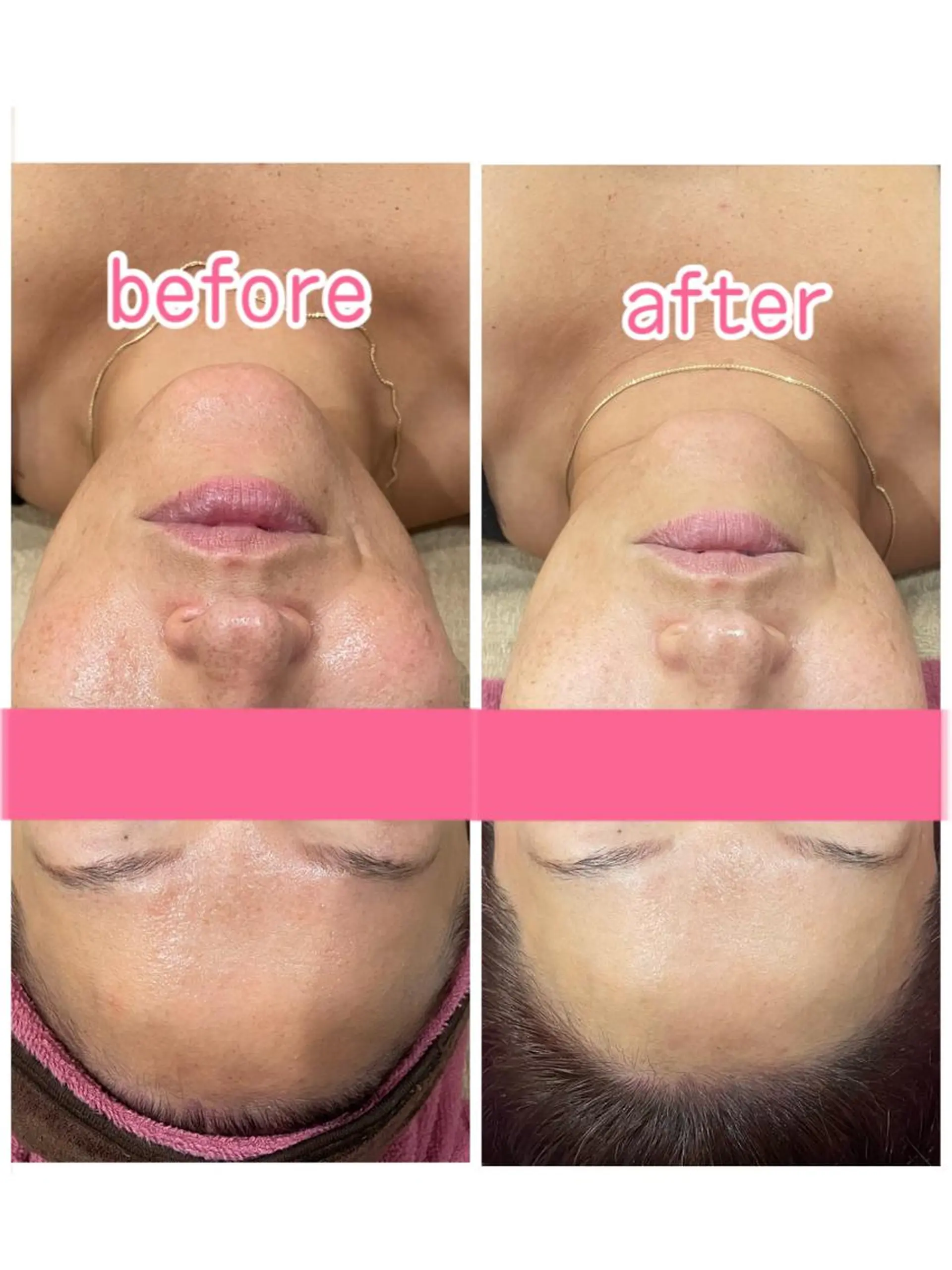 エステ リラク 脱毛&フェイシャル BiSTA〈ビスタ〉のエステ・リラクイメージ