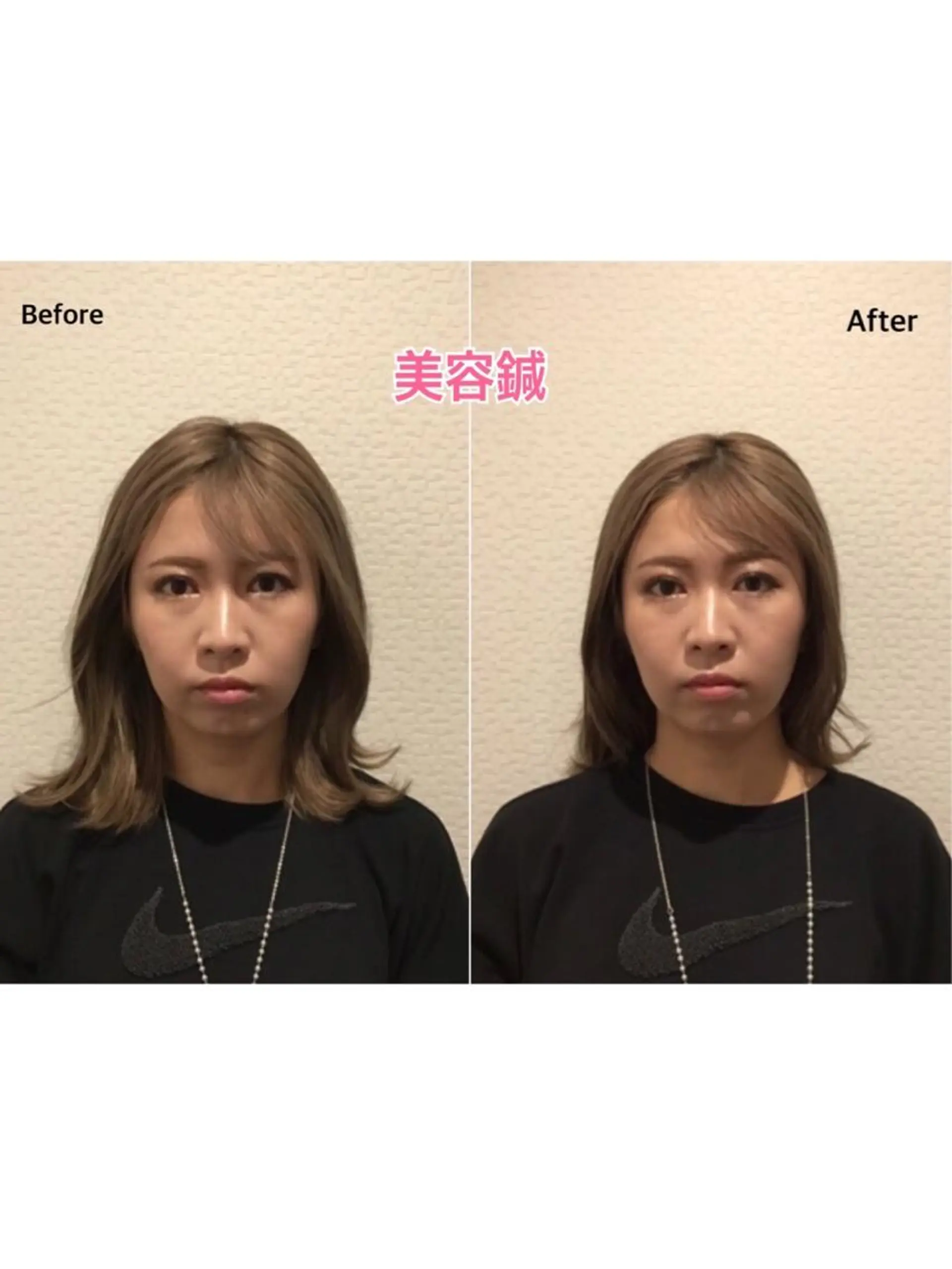 チキバン美容鍼灸整体 サロン心斎橋店のエステ・リラクイメージ