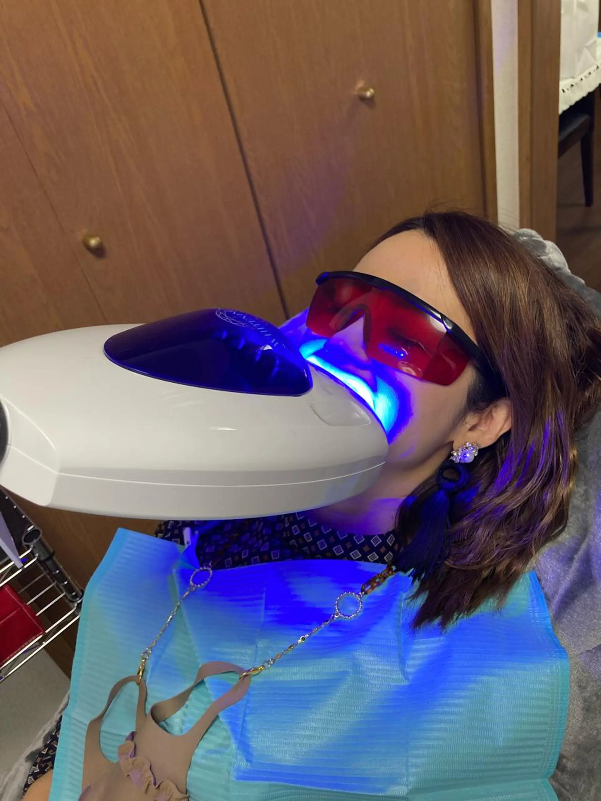 ホワイトニング シャトンのその他イメージ