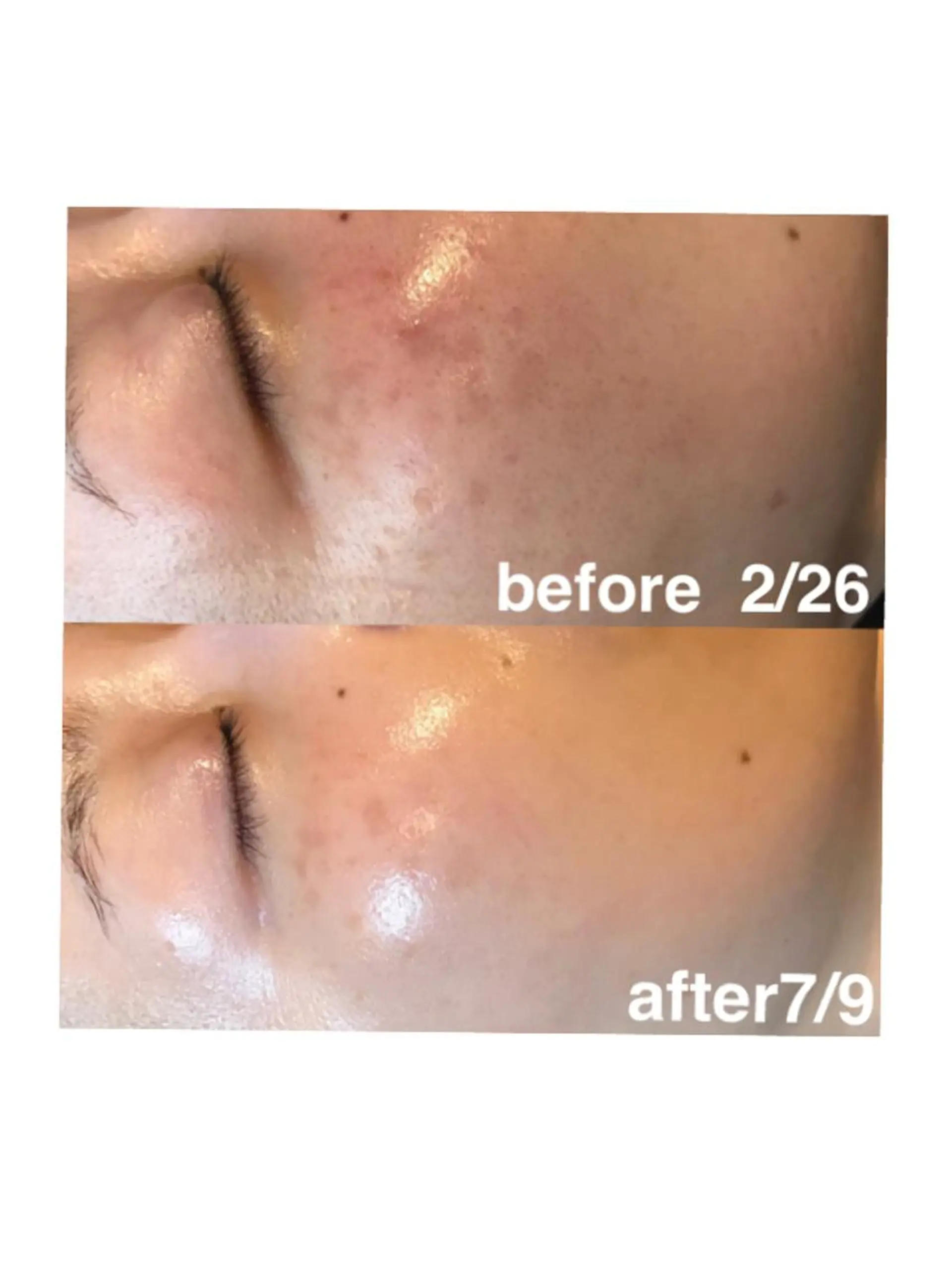 エステ 浜野 恵美のエステ・リラクイメージ