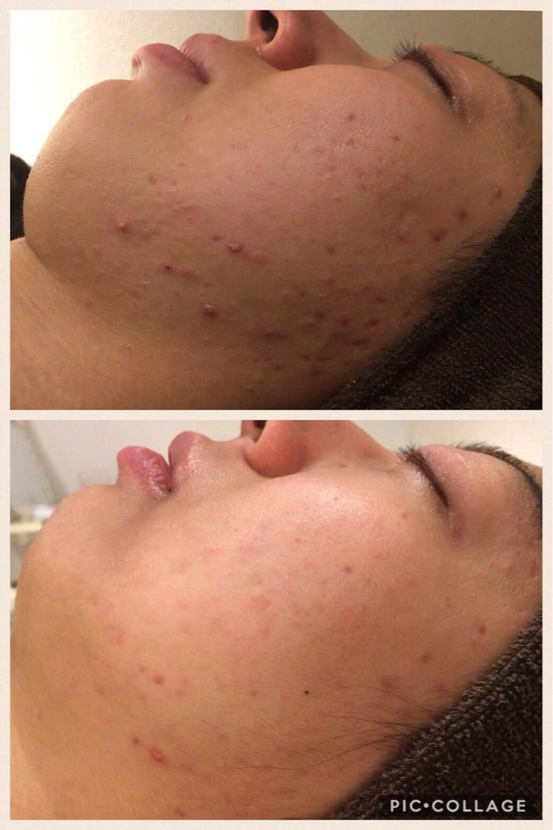 ミディアム パーマ ヘアアレンジ メンズ キッズ ネイル マツエク・マツパ エステ リラク ニキビ・肌質改善専門 ♡人生が変わるサロンのエステ・リラクイメージ