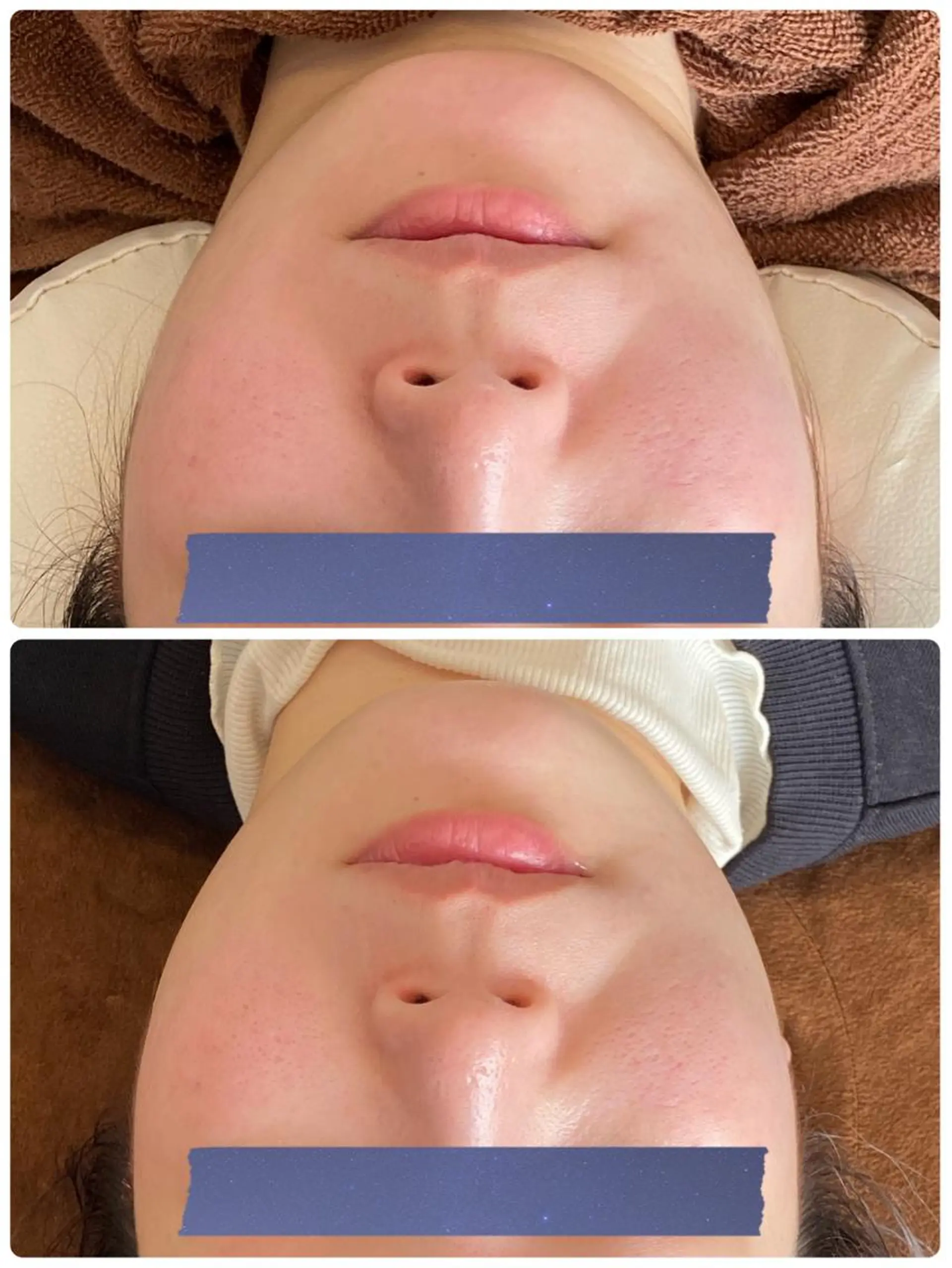 エステ FLEURフェイシャ ル🫧ハーブ🌿小顔のエステ・リラクイメージ