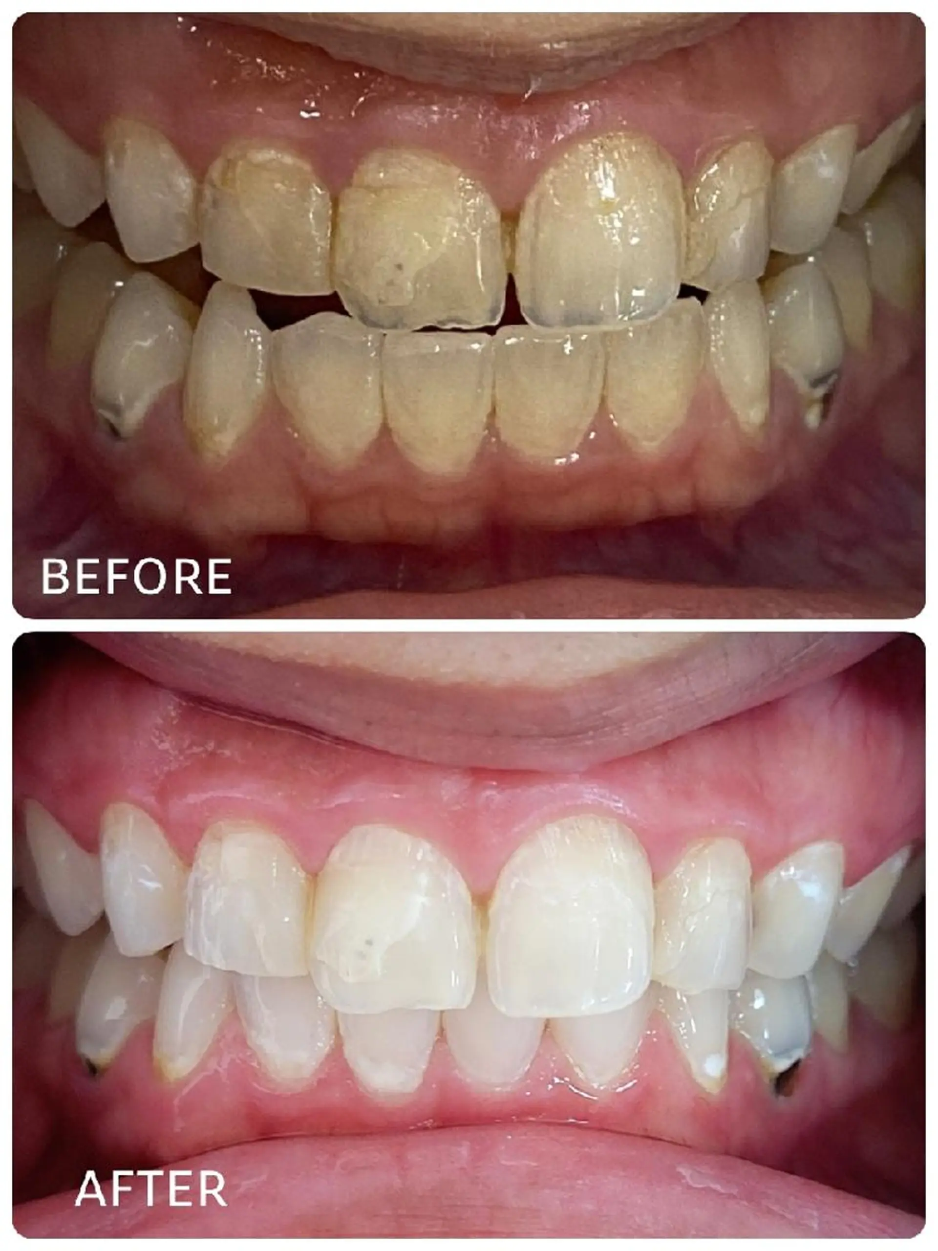 ホワイトニングサロン ラウレアのその他イメージ