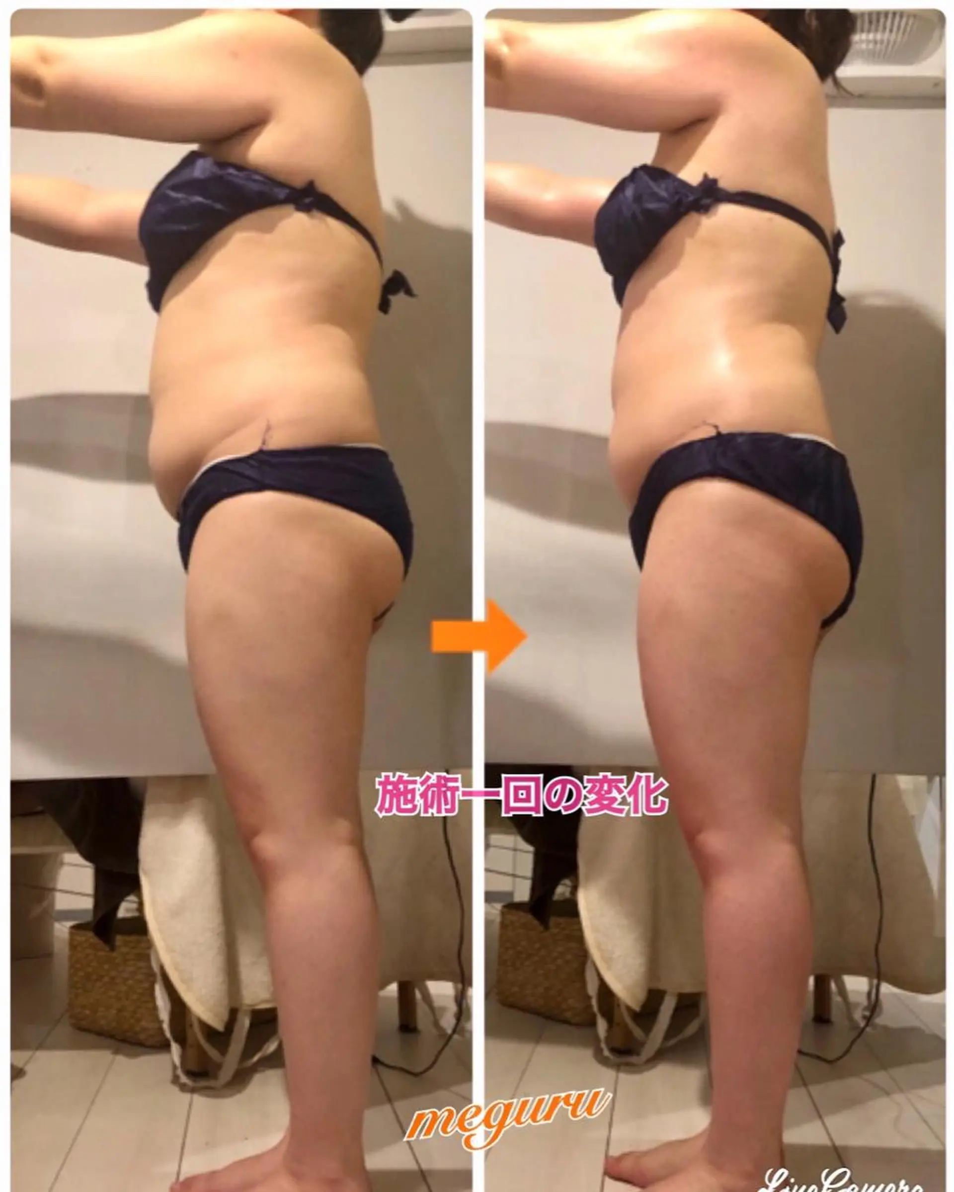 ショート カラー パーマ ヘアアレンジ メンズ キッズ ネイル マツエク・マツパ ‍痩身＆ボディ 結果出し🌟丹野のエステ・リラクイメージ