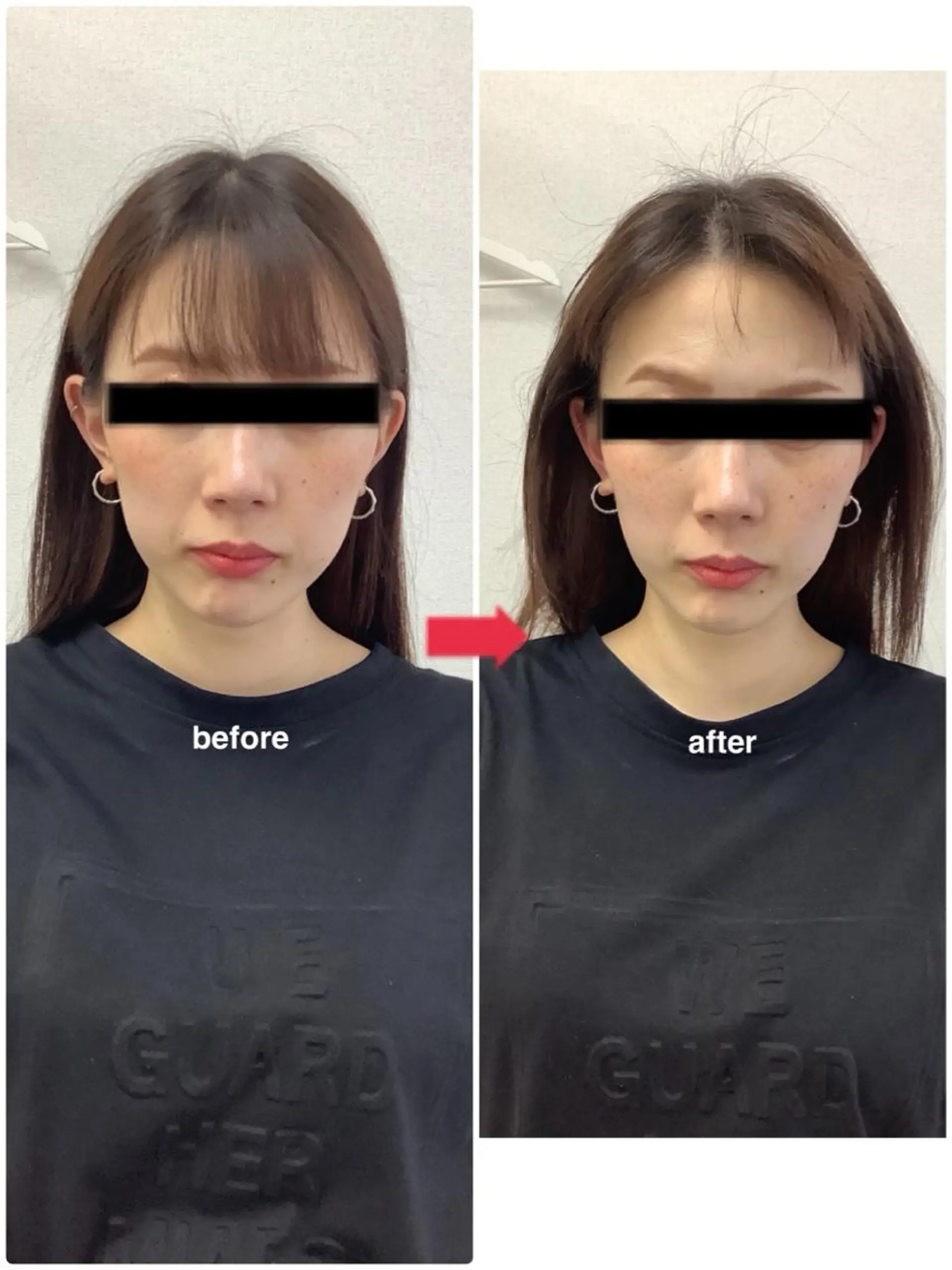 ハリサロンドオフ 美容鍼灸×小顔整体のエステ・リラクイメージ