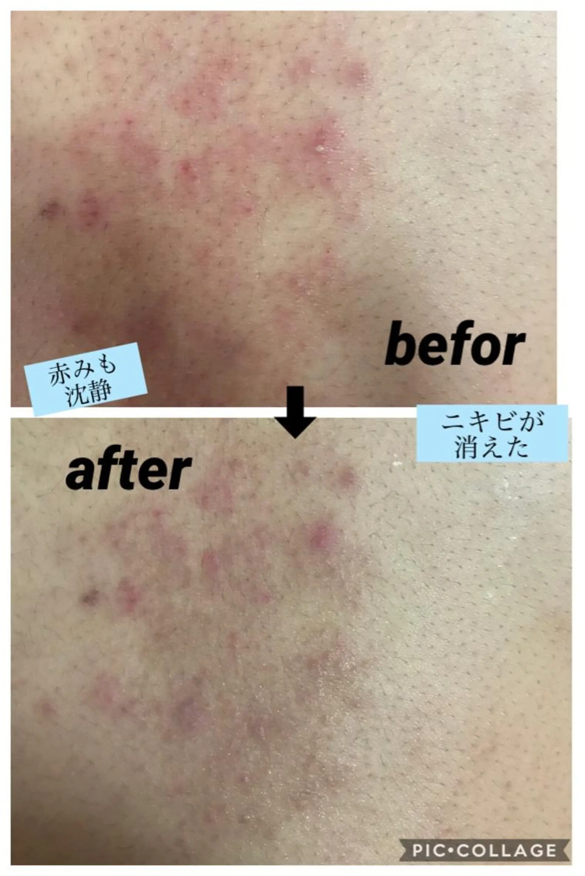 ロング カラー パーマ ヘアアレンジ メンズ キッズ ネイル マツエク・マツパ 金の糸脱毛 産毛ケア専門のエステ・リラクイメージ