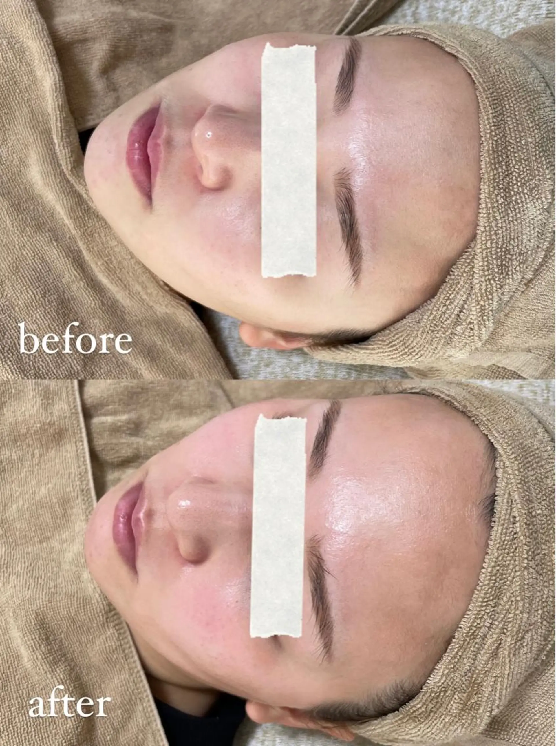 脱毛 エステサロン Mi-mi.iのエステ・リラクイメージ