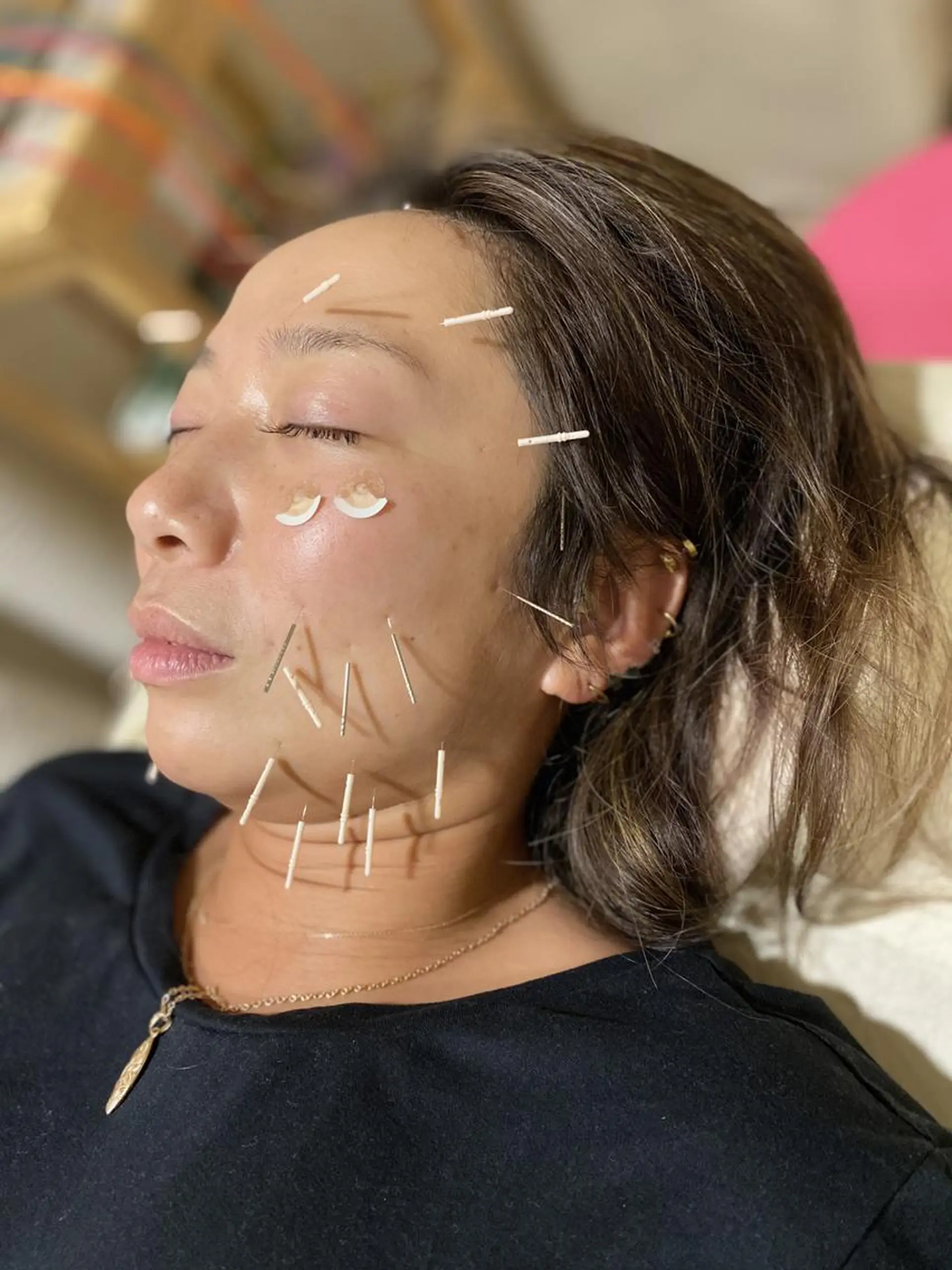 むくみたるみ専門☆ 美容鍼・小顔矯正のエステ・リラクイメージ