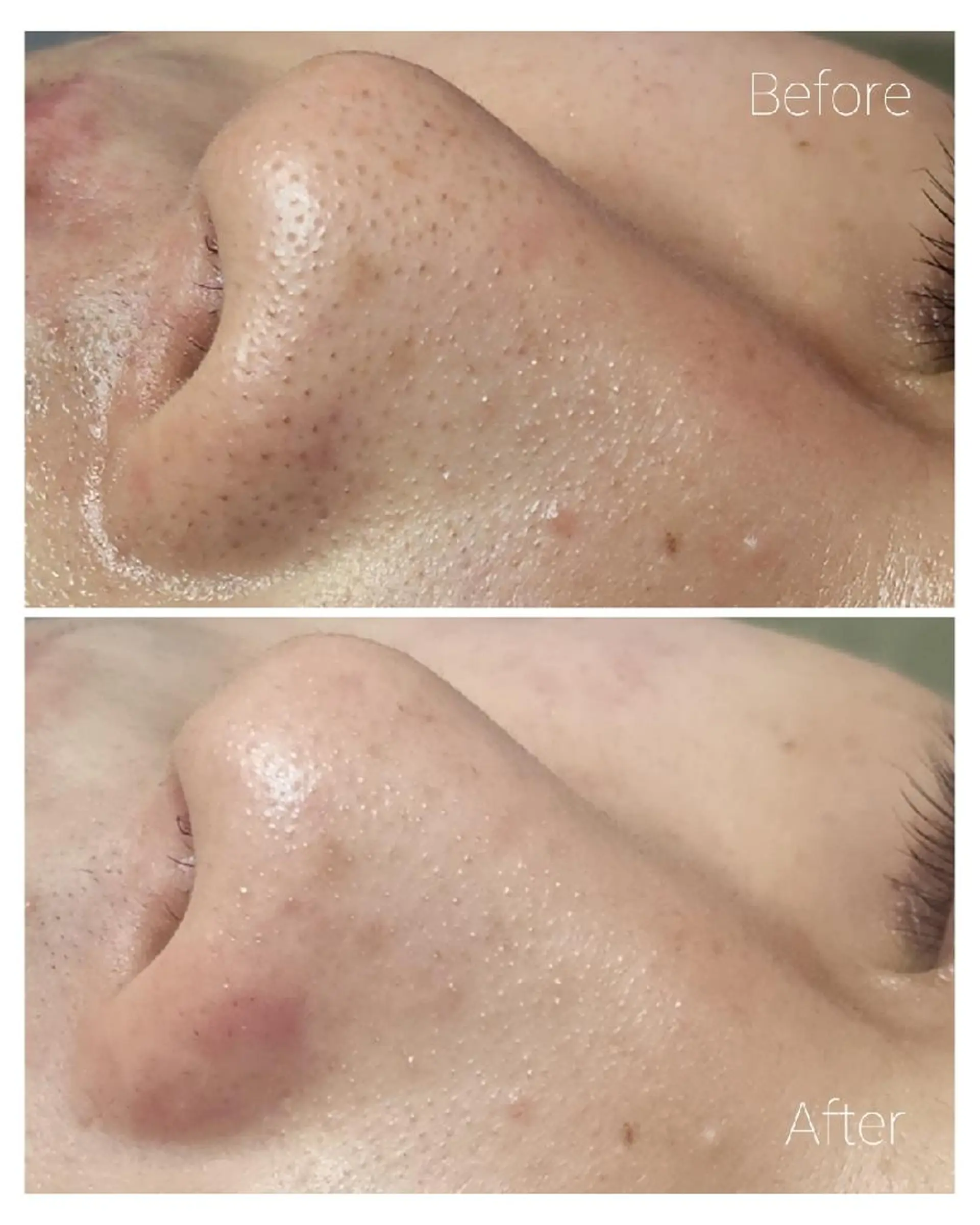 エステ ALOHA RETREATのエステ・リラクイメージ