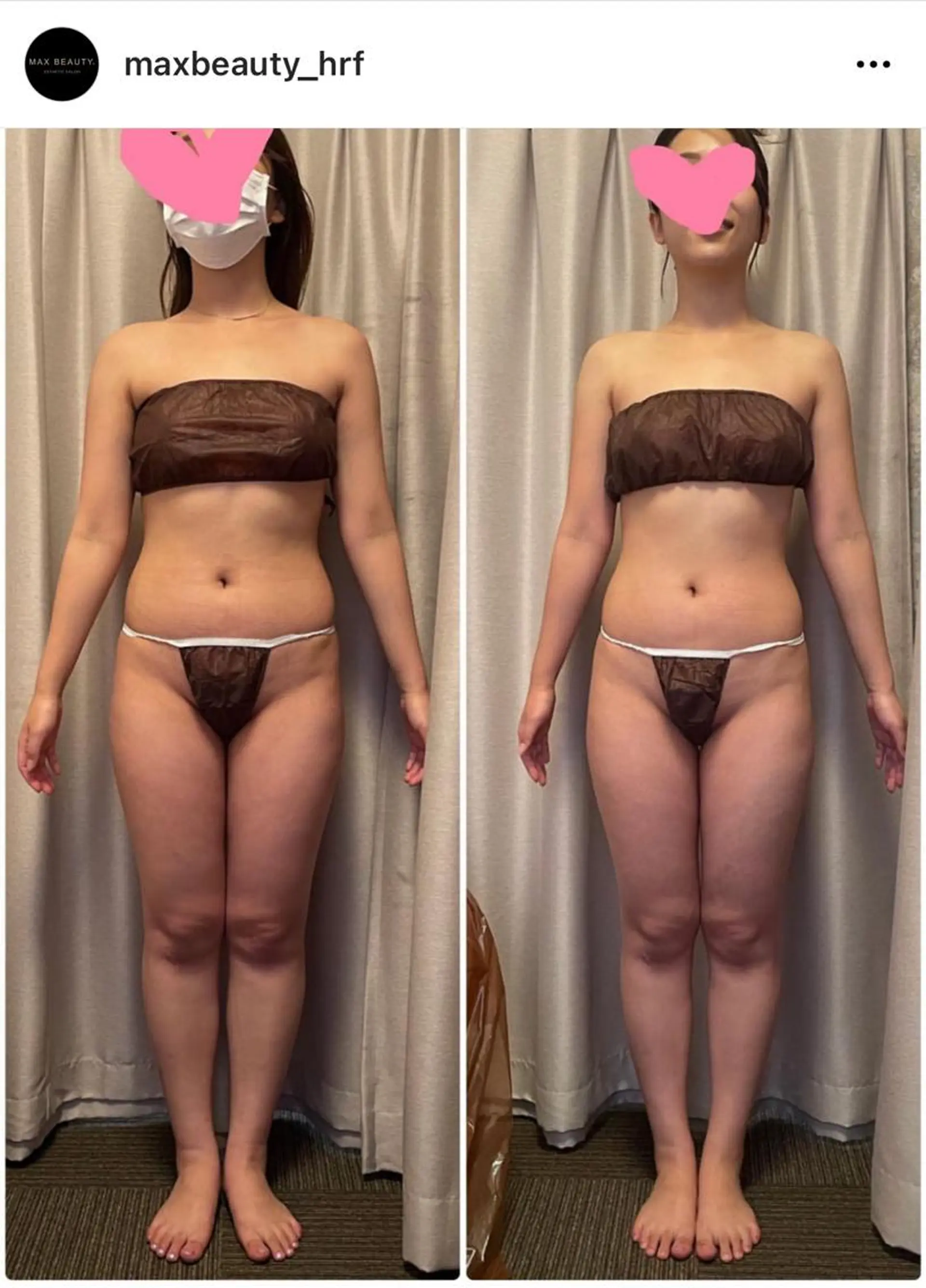 痩身/美肌/脱毛 MAX BEAUTYのエステ・リラクイメージ