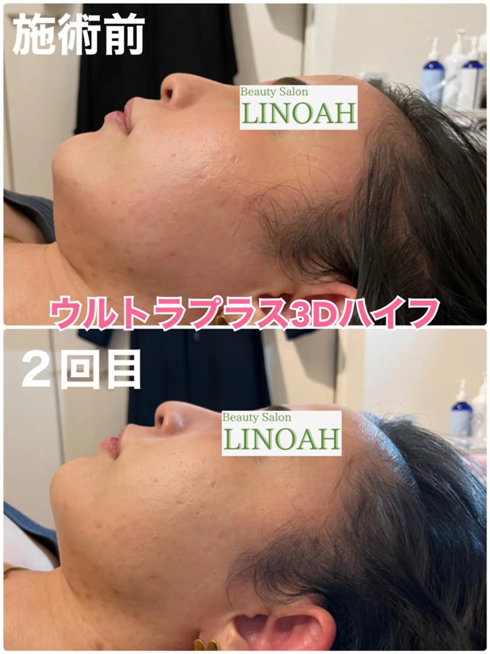 パーマ マツエク・マツパ アイブロウ メンズ エステ リラク ビューティーサロン リノアのエステ・リラクイメージ