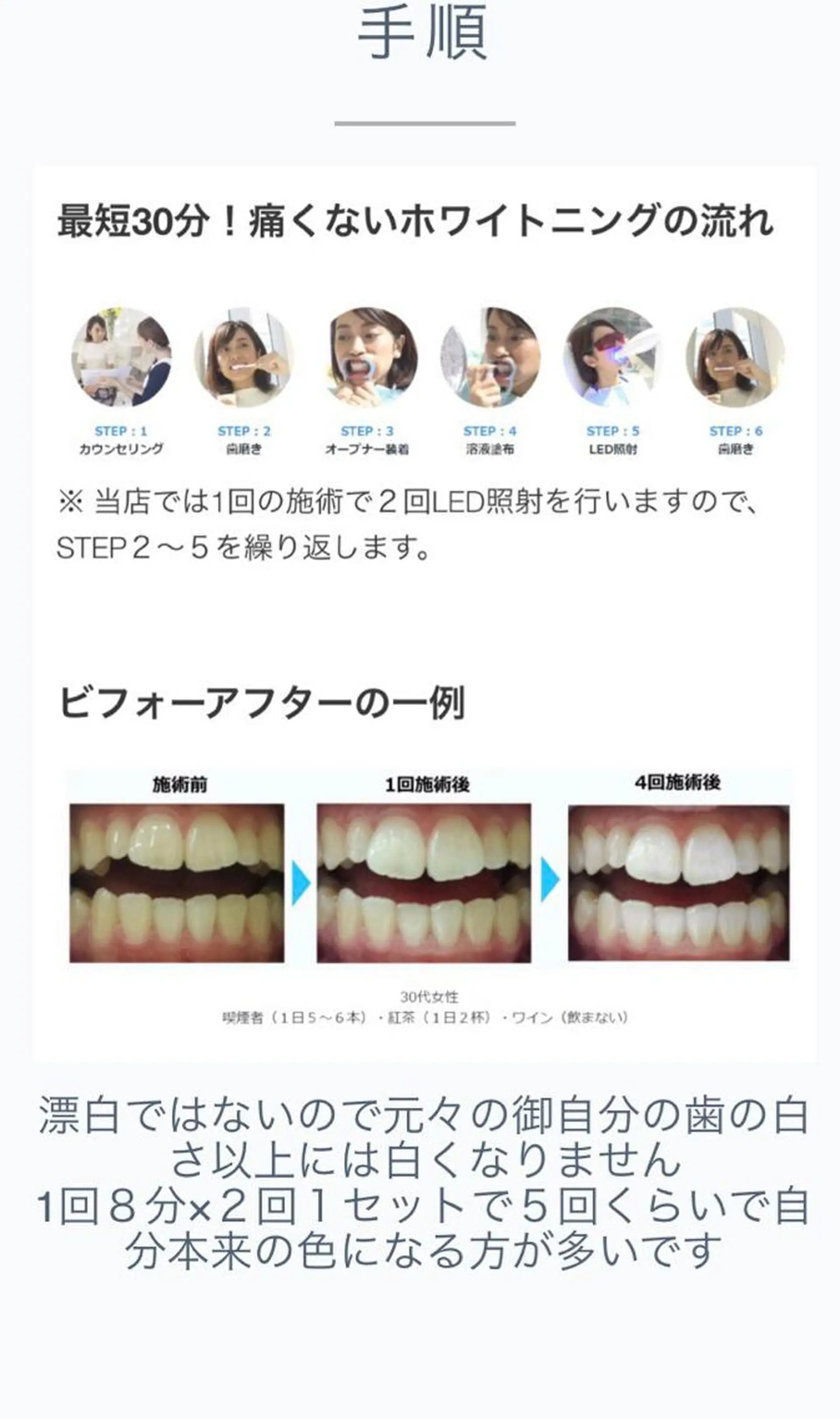 luceat Rのマツエク・マツパデザイン