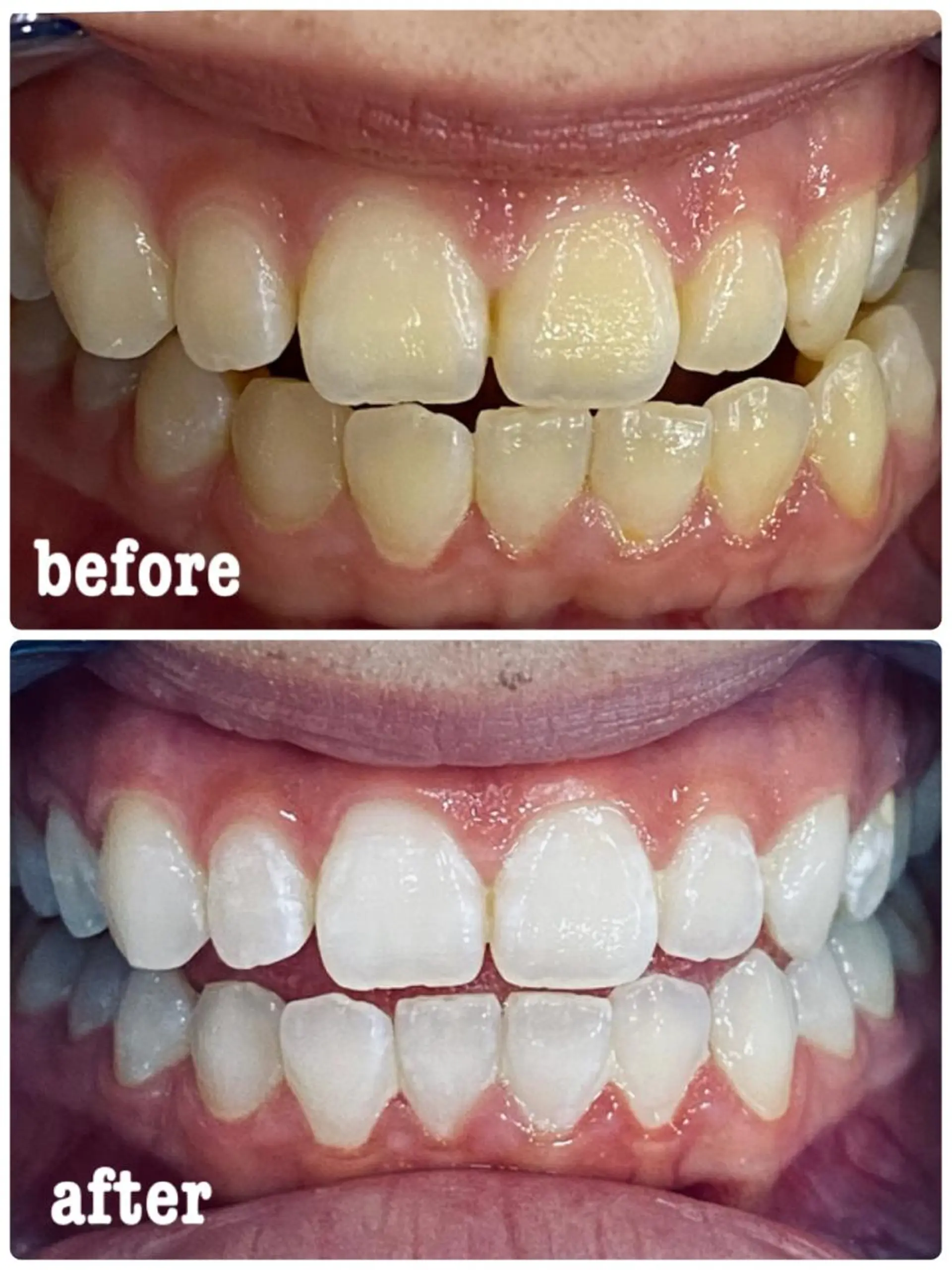 ホワイトニングサロン ラウレアのその他イメージ