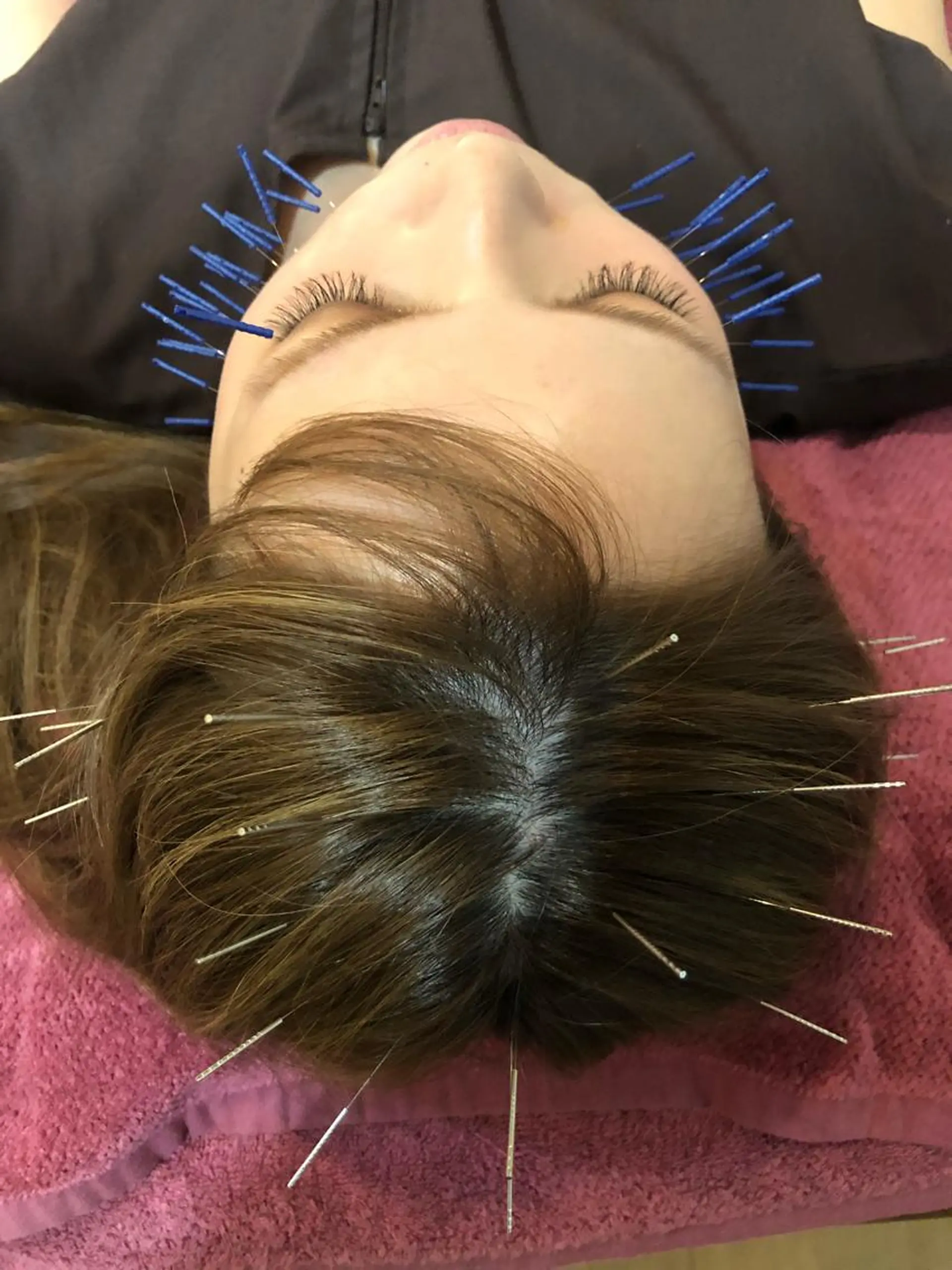 エステ リラク 美容鍼灸女性専用 りんご鍼灸治療院のその他イメージ